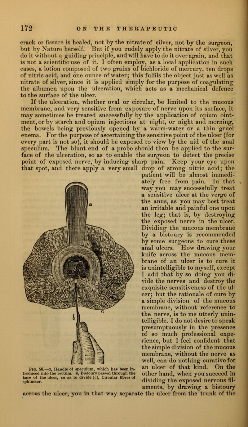 crack or fissure is healed, not by the nitrate of silver, not by the surgeon, but by Nature herself. But if you rudely apply the nitrate of silver, you do it without a guiding principle, and will have to do it over again, and that is not a scientific use of it. I often employ, as a local application in such cases, a lotion composed of two grains of bichloride of mercury, ten drops of nitric acid, and one ounce of water; this fulfils the object just as well as nitrate of silver, since it is applied simply for the purpose of coagulating the albumen upon the ulceration, which acts as a mechanical defence to the surface of the ulcer. If the ulceration, whether oval or circular, be limited to the mucous membrane, and very sensitive from exposure of nerve upon its surface, it may sometimes be treated successfully by the application of opium oint- ment, or by starch and opium injections at night, or night and morning, the bowels being previously opened by a warm-water or a thin gruel enema. For the purpose of ascertaining the sensitive point of the ulcer (for every part is not so), it should be exposed to view by the aid of the anal speculum. The blunt end of a probe should then be applied to the sur- face of the ulceration, so as to enable the surgeon to detect the precise point of exposed nerve, by inducing sharp pain. Keep your eye upon that spot, and there apply a very small drop of strong nitric acid; the patient will be almost immedi- ately free from pain. In that way you may successfully treat a sensitive ulcer at the verge of the anus, as you may best treat an irritable and painful one upon the leg; that is, by destroying the exposed nerve in the ulcer. Dividing the mucous membrane by a bistoury is recommended by some surgeons to cure these anal ulcers. How drawing your knife across the mucous mem- brane of an ulcer is to cure it is unintelligible to myself, except I add that by so doing you di- vide the nerves and destroy the exquisite sensitiveness of the ul- cer; but the rationale of cure by a simple division of the mucous membrane, without reference to the nerve, is to me utterly unin- telligible. I do not desire to speak presumptuously in the presence of so much professional expe- rience, but I feel confident that the simple division of the mucous membrane, without the nerve as well, can do nothing curative for an ulcer of that kind. On the other hand, when you succeed in dividing the exposed nervous fil- aments, by drawing a bistoury across the ulcer, you in that way separate the ulcer from the trunk of the Fig. 56.—o, Handle of speculum, which has been in- troduced into the rectum. 6, Bistoury passed through the base of the ulcer, so as to divide (c), Circular fibres of sphincter.