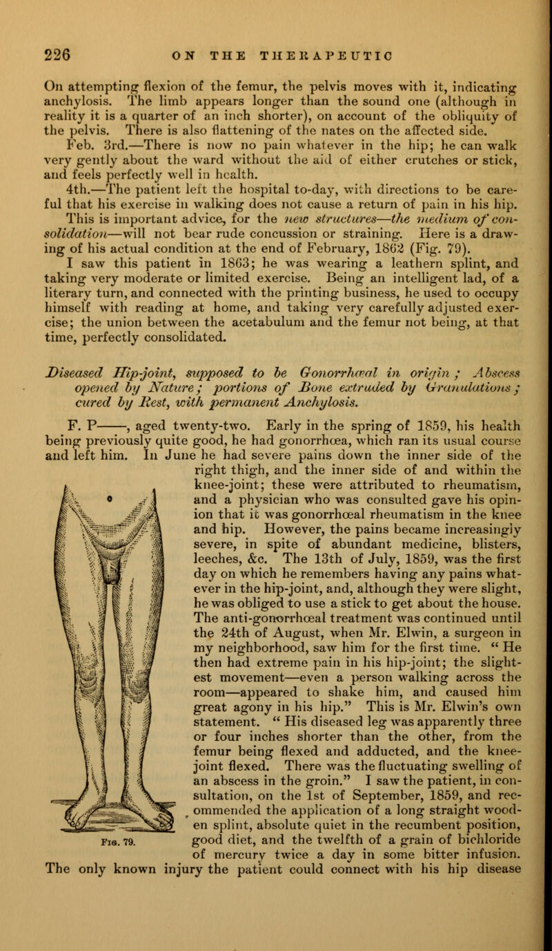 On attempting flexion of the femur, the pelvis moves with it, indicating anchylosis. The limb appears longer than the sound one (although in reality it is a quarter of an inch shorter), on account of the obliquity of the pelvis. There is also flattening of the nates on the affected side. Feb. 3rd.—There is now no pain whatever in the hip; he can walk very gently about the ward without the aid of either crutches or stick, and feels perfectly well in health. 4th.—The patient left the hospital to-day, with directions to be care- ful that his exercise in walking does not cause a return of pain in his hip. This is important advice, for the new structures—the medium of con- solidation—will not bear rude concussion or straining. Here is a draw- ing of his actual condition at the end of February, 1862 (Fig. 79). I saw this patient in 1803; he was wearing a leathern splint, and taking very moderate or limited exercise. Being an intelligent lad, of a literary turn, and connected with the printing business, he used to occupy himself with reading at home, and taking very carefully adjusted exer- cise; the union between the acetabulum and the femur not being, at that time, perfectly consolidated. Diseased Hip-joint, supposed to be Gonorrheal in origin; Abscess opened by Nature; portions of Hone extruded by Granulationsy cured by Itest, with permanent Anchylosis. F. P , aged twenty-two. Early in the spring of 1859, his health being previously quite good, he had gonorrhoea, which ran its usual course and left him. In June he had severe pains down the inner side of the right thigh, and the inner side of and within the knee-joint; these were attributed to rheumatism, and a physician who was consulted gave his opin- ion that it was gonorrhceal rheumatism in the knee and hip. However, the pains became increasingly severe, in spite of abundant medicine, blisters, leeches, &c. The 13th of July, 1859, was the first day on which he remembers having any pains what- ever in the hip-joint, and, although they were slight, he was obliged to use a stick to get about the house. The anti-gonorrhceal treatment was continued until the 24th of August, when Mr. Elwin, a surgeon in my neighborhood, saw him for the first time.  He then had extreme pain in his hip-joint; the slight- est movement—even a person walking across the room—appeared to shake him, and caused him great agony in his hip. This is Mr. Elwin's own statement.  His diseased leg was apparently three or four inches shorter than the other, from the femur being flexed and adducted, and the knee- joint flexed. There was the fluctuating swelling of an abscess in the groin. I saw the patient, in con- sultation, on the 1st of September, 1859, and rec- w ommended the application of a long straight wood- en splint, absolute quiet in the recumbent position, Fia. 79. good diet, and the twelfth of a grain of bichloride of mercury twice a day in some bitter infusion. The only known injury the patient could connect with his hip disease