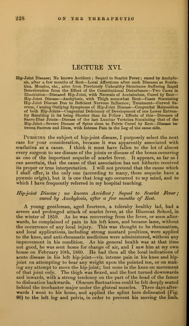 LECTURE XVI. Hip-Joint Disease; No known Accident; Sequel to Scarlet Fever; cured by Anchylo- sis, after a few months of Rest—Local Affections after such Diseases as Scarla- tina, Measles, etc., arise from Previously Unhealthy Structures Suffering Rapid Deterioration from the Effect of the Constitutional Disturbance—Two Cases in Illustration—Diseased Hip-Joint, with Necrosis of Acetabulum, Cured by Rest— Hip-Joint Disease—Anchylosis, with Thigh somewhat Bent—Cases Simulating Hip-Joint Disease Due to Deficient Nervous Influence; Treatment—Curved Sa- crum, Causing Outlying Symptoms of Hip-Joint Disease—Congenital Malposition of both Hip-Joints—Congenital Deficiency of Development of one Lower Extrem- ity Resulting in its being Shorter than its Fellow ; Effects of this—Diseases of Sacro-IKac Joints—Disease of the last Lumbar Vertebra Simulating that of the Hip-Joint—Severe Disease of Spine close to Pelvis Cured by Rest—Disease be- tween Sacrum and Ilium, with Intense Pain in the Leg of the same side. Pursuing the subject of hip-joint disease, I purposely select the next case for your consideration, because it was apparently associated with scarlatina as a cause. I think it must have fallen to the lot of almost every surgeon to see disease of the joints or disease of the bones occurring as one of the important sequelae of scarlet fever. It appears, as far as I can ascertain, that the cause of that association has not hitherto received its proper or true interpretation. I will not pretend that the cause which I shall offer, is the only one (according to many, these sequelae have a pyaemic origin), but it is one that long ago occurred to my mind, and to which I have frequently referred in my hospital teaching. Hip-joint Disease; no known Accident; Sequel to Scarlet Fever; cured by Anchylosis, after a few months of Rest. A young gentleman, aged fourteen, a toleraby healthy lad, had a severe and prolonged attack of scarlet fever, at the Bluecoat School, in the winter of 1859. As he was recovering from the fever, or soon after- wards, he complained of pain in his left knee, and became lame, without the occurrence of any local injury. This was thought to be rheumatism, and local applications, including strong mustard poultices, were applied to the knee, and anti-rheumatic medicines were administered, without any improvement in his condition. As his general health was at that time not good, he was sent home for change of air, and I saw him at my own house on February 10th, 1860. He had then all the local indications of acute disease in his left hip-joint—viz. intense pain in his knee and hip- joint on attempting to bear any weight upon the pointed toe, or on mak- ing any attempt to move the hip-joint; but none in the knee on movement of that joint only. The thigh was flexed, and the foot turned downwards and inwards, with a strong tendency on the part of the head of the femur to dislocation backwards. Obscure fluctuations could be felt deeply seated behind the trochanter major under the gluteal muscles. Three days after- wards 1 went to his home, and applied the splint here delineated (Fig. 80) to the left leg and pelvis, in order to prevent his moving the limb.