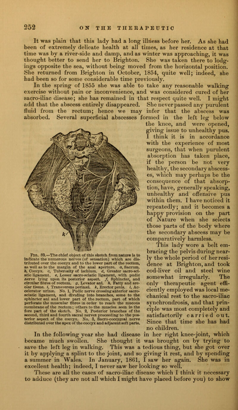 It was plain that this lady had a long illness before her. As she had been of extremely delicate health at all times, as her residence at that time was by a river-side and damp, and as winter was approaching, it was thought better to send her to Brighton. She was taken there to lodg- ings opposite the sea, without being moved from the horizontal position. She returned from Brighton in October, 1854, quite well; indeed, she had been so for some considerable time previously. In the spring of 1855 she was able to take any reasonable walking exercise without pain or inconvenience, and was considered cured of her sacro-iliac disease; she has remained in that respect quite well. I might add that the abscess entirely disappeared. She never passed any purulent fluid from the rectum; hence we may infer that the abscess was absorbed. Several superficial abscesses formed in the left leg below the knee, and were opened, giving issue to unhealthy pus. I think it is in accordance with the experience of most surgeons, that when purulent absorption has taken place, if the person be not very healthy, the secondary abscess- es, which may perhaps be the consequence of that absorp- tion, have, generally speaking, unhealthy and offensive pus within them. I have noticed it repeatedly; and it becomes a happy provision on the part of Nature when she selects those parts of the body where the secondary abscess may be comparatively harmless. This lady wore a belt em- bracing the pelvis during near- ly the whole period of her resi- dence at Brighton, and took cod-liver oil and steel wine somewhat irregularly. The only therapeutic agent effi- ciently employed was local me- chanical rest to the sacro-iliac synchrondrosis, and that prin- ciple was most completely and satisfactorily carried out. Since that time she has had no children. In the following year she had disease in her right knee-joint, which became much swollen. She thought it was brought on by trying to save the left leg in walking. This was a tedious thing, but she got over it by applying a splint to the joint, and so giving it rest, and by spending a summer in Wales. In January, 1861, I saw her again. She was in excellent health; indeed, I never saw her looking so well. These are all the cases of sacro-iliac disease which I think it necessary to adduce (they are not all which I might have placed before you) to show Fig. 89.—The chief object of this sketch from nature is to indicate the numerous nerves (of sensation) which are dis- tributed over the coccyx and to the lower part of the rectum, as well as to the margin of the anal aperture, a, Sacrum. 6, Coccyx, c, Tuberosity of ischium, rf, Greater sacro-sci- atic ligament, e, Lesser sacro-sciatic ligament, with pudic nerve lying upon its posterior aspect. /, Sphincter, and circular fibres of rectum, g, Levator ani. h. Fatty and are- olar tissue. ?, Transversus perinaei. k, Erector penis. /, Ac- celerator urinse. No. 1, Pudic nerve crossing anterior sacro- sciatic ligament, and dividing into branches, some to the sphincter ani and lower part of the rectum, part of which perforate the muscular fibres in order to reach the mucous membrane of the rectum; others to the muscles seen in the fore part of the sketch. No. 2, Posterior branches of the second, third and fourth sacral nerves proceeding to the pos- terior aspect of the coccyx. No. 3, Sacro-coccygeal nerve distributed over the apex of the coccyx and adjacent soft parts.