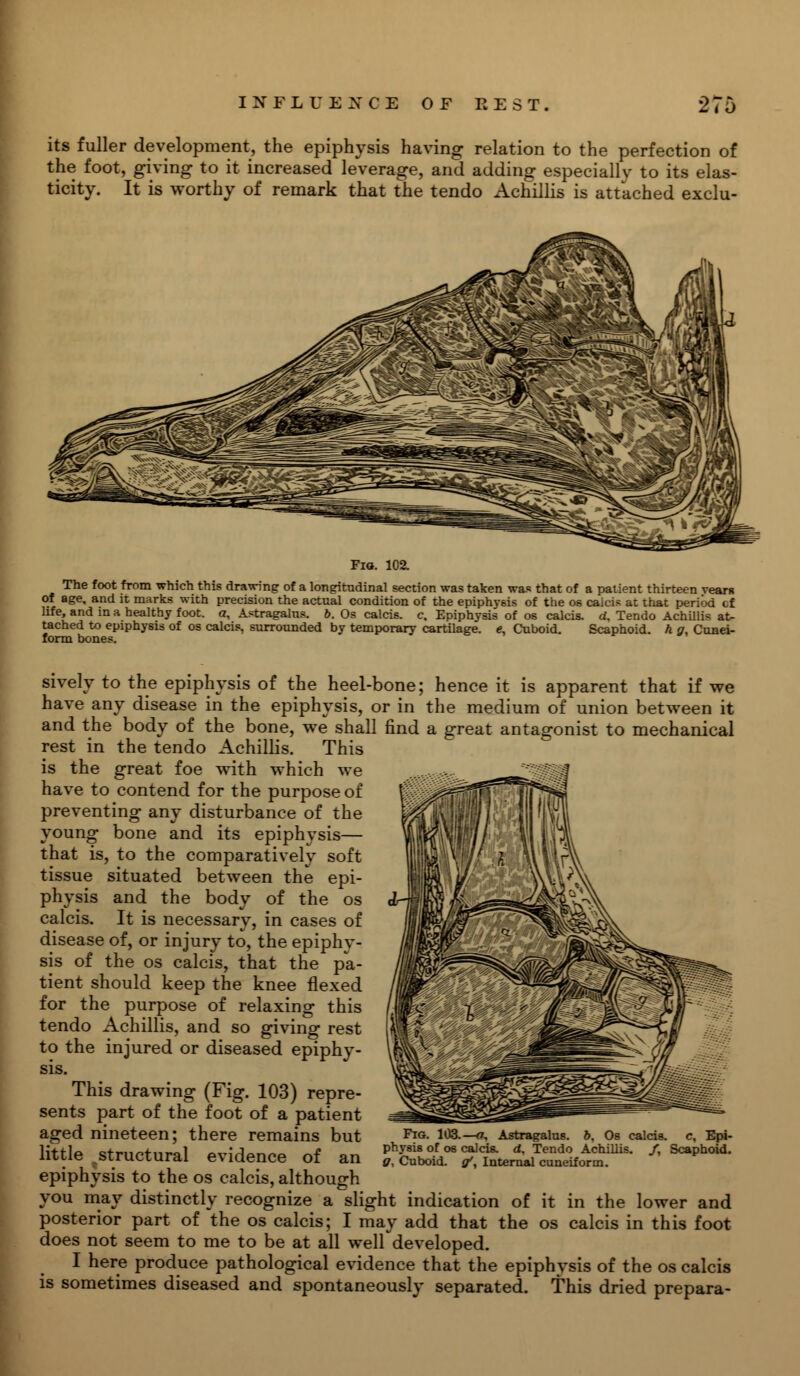 its fuller development, the epiphysis having relation to the perfection of the foot, giving to it increased leverage, and adding especially to its elas- ticity. It is worthy of remark that the tendo Achillis is attached exclu- Fio. 102. The foot from which this drawing of a longitudinal section was taken was that of a patient thirteen vear* of age, and it marks with precision the actual condition of the epiphysis of the os caicis at that period cf life, and in a healthy foot, a, Astragalus, b. Os calcis. c. Epiphysis of os calcis. d, Tendo Achillis at- tached to epiphysis of os calcis, surrounded by temporary cartilage, e, Cuboid. Scaphoid, k g, Cunei- form bones. sively to the epiphysis of the heel-bone; hence it is apparent that if we have any disease in the epiphysis, or in the medium of union between it and the body of the bone, we shall find a great antagonist to mechanical rest in the tendo Achillis. This is the great foe with which we have to contend for the purpose of preventing any disturbance of the young bone and its epiphysis— that is, to the comparatively soft tissue situated between the epi- physis and the body of the os calcis. It is necessary, in cases of disease of, or injury to, the epiphy- sis of the os calcis, that the pa- tient should keep the knee flexed for the purpose of relaxing this tendo Achillis, and so giving rest to the injured or diseased epiphy- sis. This drawing (Fig. 103) repre- sents part of the foot of a patient aged nineteen; there remains but little ^ structural evidence of an epiphysis to the os calcis, although you may distinctly recognize a slight indication of posterior part of the os calcis; I may add that the does not seem to me to be at all well developed. I here produce pathological evidence that the epiphysis of the os calcis is sometimes diseased and spontaneously separated. This dried prepara- Fig. 103.—«, Astragalus. 6. Os calcis. c, Epi- physis of os calcis. d, Tendo Achillis. /, Scaphoid. g, Cuboid, g', Internal cuneiform. It in the lower and calcis in this foot