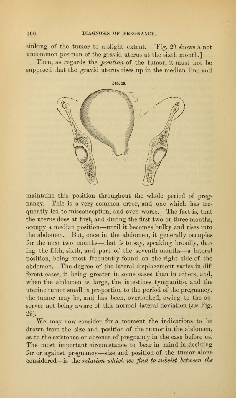 sinking of the tumor to a slight extent. [Fig. 29 shows a not uncommon position of the gravid uterus at the sixth month.] Then, as regards the position of the tumor, it must not be supposed that the gravid uterus rises up in the median line and Fig. 29. maintains this position throughout the whole period of preg- nancy. This is a very common error, and one which has fre- quently led to misconception, and even worse. The fact is, that the uterus does at first, and during the first two or three months, occupy a median position—until it becomes bulky and rises into the abdomen. But, once in the abdomen, it generally occupies for the next two months—that is to say, speaking broadly, dur- ing the fifth, sixth, and part of the seventh months—a lateral position, being most frequently found on the right side of the abdomen. The degree of the lateral displacement varies in dif- ferent cases, it being greater in some cases than in others, and, when the abdomen is large, the intestines tympanitic, and the uterine tumor small in proportion to the period of the pregnancy, the tumor may be, and has been, overlooked, owing to the ob- server not being aware of this normal lateral deviation {see Fig. 29). We may now consider for a moment the indications to be drawn from the size and position of the tumor in the abdomen, as to the existence or abseuce of pregnancy in the case before us. The most important circumstance to bear in mind in deciding for or against pregnancy—size and position of the tumor alone considered—is the 7'elation which we find to subsist between the