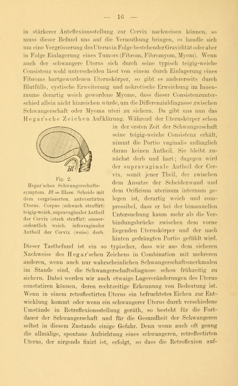 in stärkerer A.nteflexionsstellung zur Cervix nachweisen können, so muss dieser Befund uns auf die Vernmthung bringen, es handle sich Hin eine Vergrösserung des I Iterusin Folge bestehender Gravidität oder aber in Folge Einlagerung eines Tumors (Fibrom, Fibromyom, Myom). Wenn auch der schwangere Uterus sich durch seine typisch teigig-weiche Consistenz wohl unterscheiden lässt von einem durch Einlagerung eines Fibroms hartgewordenen Uteruskörper, so gibt es andererseits durch Blutfülle, cystische Erweiterung und nekrotische Erweichung im Innen- raume derartig weich gewordene Myome, dass dieser Consistenzunter- schied allein nicht hinreichen würde, um die DifTerenzialdiagnose zwischen Schwangerschaft oder Myoma uteri zu sichern. Da gibt uns nun das Hegaus che Zeichen Aufklärung. Während der Uteruskörper schon in der ersten Zeit der Schwangerschaft seine teigig-weiche Consistenz erhält, nimmt die Portio vaginalis anfänglich daran keinen Antheil. Sie bleibt zu- nächst derb und hart; dagegen wird der supravaginale Antheil der Cer- vix. somit jener Theil, der zwischen dem Ansätze der Scheidenwand und dem Orificium uterinum internum ge- legen ist, derartig weich und com- pressibel, dass er bei der bimanuellen Untersuchung kaum mehr als die Ver- bindungsbrücke zwischen dem vorne liegenden Uteruskörper und der nach hinten gedrängten Portio gefühlt wird. Dieser Tastbefund ist ein so typischer, dass wir aus dem sicheren Xachweise des Hegar sehen Zeichens in Combination mit mehreren anderen, wenn auch nur wahrscheinlichen Schwangerschaftsmerkmalen im Stande sind, die Schwangerschaftsdiagnose schon frühzeitig zu sichern. Dabei werden wir auch etwaige Lageveränderungen des Uterus constatiren können, deren rechtzeitige Erkennung von Bedeutung ist. Wenn in einem retroflectirten Uterus ein befruchtetes Eichen zur Ent- wicklung kommt oder wenn ein schwangerer Uterus durch verschiedene Umstände in Retroflexionsstellung geräth, so besteht für die Fort- dauer der Schwangerschaft und für die Gesundheit der Schwangeren selbst in diesem Zustande einige Gefahr. Denn wenn auch oft genug die allmälige, spontane Aufrichtung eines schwangeren, retroflectirten Uterus, der nirgends fixirt ist, erfolgt, so dass die Retroflexion auf- Fig. 2. Hegarsches Schwangerschafts- symptorn. Bl = Blase. Scheide mit dem vergrösserten. antevertirten Uterus. Corpus (schwach straffirt) teigig-weich, supravaginaler Antheil der Cervix (stark straffirt) ausser- ordentlich weich, infravaginaler Antheil der Cervix (weiss) derb.