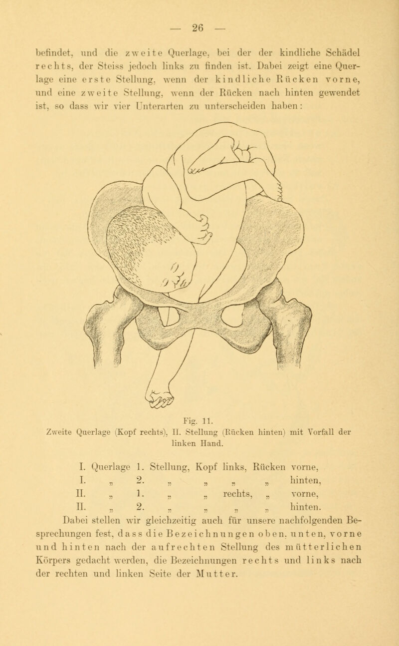 befindet, und die zweite Querlage, bei der der kindliche Schädel rechts, der Steiss jedoch links zu finden ist. Dabei zeigt eine Quer- lage eine erste Stellung, wenn der kindliche Rücken vorne, und eine zweite Stellung, wenn der Rücken nach hinten gewendet ist. so dass wir vier Unterarten zu unterscheiden haben: ^sp- Fig. 11. Zweite Querlage iKopf rechts), II. Stellung (Rücken hinten» mit Vorfall der linken Hand. I. Querlage 1. Stellung, Kopf links, Rücken vorne, I. „ 2. .. „ „ „ hinten, IL „ 1. .. „ rechts, „ vorne, IL .. 2. .. .. ., hinten. Dabei stellen wir gleichzeitig auch für unsere nachfolgenden Be- sprechungen fest, dass die Bezeichnungen oben, unten, vorne und hinten nach der aufrechten Stellung des mütterlichen Körpers gedacht werden, die Bezeichnungen rechts und links nach der rechten und linken Seite der Mutter.