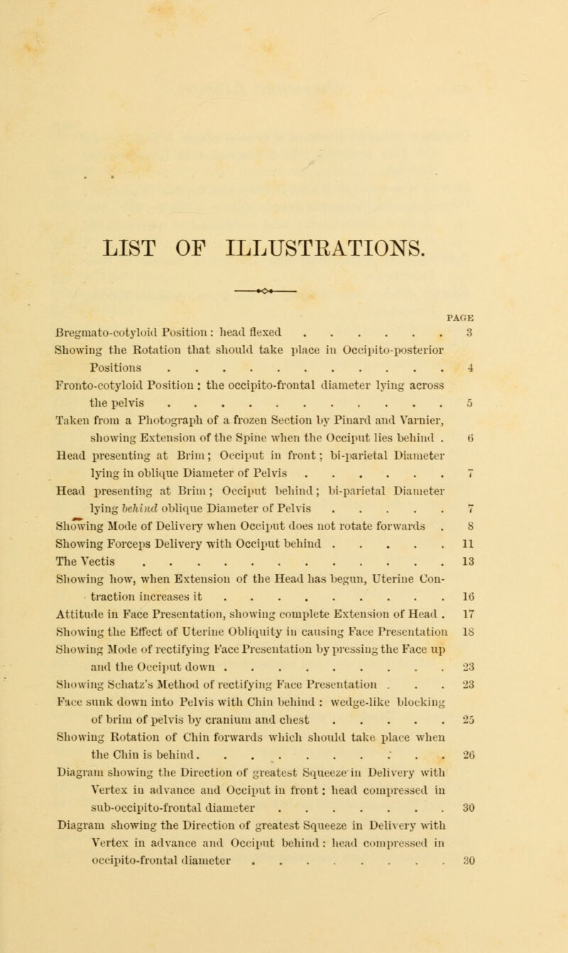 LIST OF ILLUSTEATIONS. PAGE Bregmato-cotyloid Position: head flexed 3 Showing the Rotation that should take place in Occipito-posterior Positions 4 Fronto-cotyloid Position : the occipito-frontal diameter lying across the pelvis 5 Taken from a Photograph of a frozen Section by Pinard and Varnier, showing Extension of the Spine when the Occiput lies behind . t3 Head presenting at Brim; Occiput in front; bi-parietal Diameter lying in oblique Diameter of Pelvis 7 Head presenting at Brim; Occiput behind; bi-parietal Diameter lying behind oblique Diameter of Pelvis 7 Showing Mode of Delivery when Occiput does not rotate forwards . 8 Showing Forceps Delivery with Occiput behind 11 The Vectis 13 Showing how, when Extension of the Head has begun, Uterine Con- traction increases it 10 Attitude in Face Presentation, showing complete Extension of Head . 17 Showing the Effect of Uterine Obliquity in causing Face Presentation 18 Showing Mode of rectifying Face Presentation by pressing the Face up and the Occiput down -23 Showing Schatz's Method of rectifying Face Presentation . . .23 Face sunk down into Pelvis with Chin behind : wedge-like blocking of brim of pelvis by cranium and chest 25 Showing Rotation of Chin forwards which should take place when the Chin is behind 26 Diagram showing the Direction of greatest Squeeze in Delivery with Vertex in advance and Occiput in front: head compressed in sub-occipito-frontal diameter 30 Diagram showing the Direction of greatest Squeeze in Delivery with Vertex in advance and Occiput behind : head compressed in occipito-frontal diameter 30