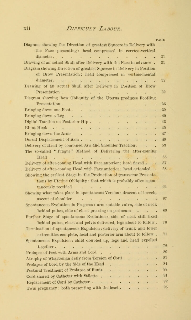 PAGE Diagram showing the Direction of greatest Squeeze in Delivery with the Face presenting : head compressed in cervico-vertical diameter 31 Drawing of an actual Skull after Delivery with the Face in advance . 31 Diagram showing Direction of greatest Squeeze in Delivery in Position of Brow Presentation: head compressed in vertico-mental diameter 32 Drawing of an actual Skull after Delivery in Position of Brow Presentation 32 Diagram showing how Obliquity of the Uterus produces Footling Presentation 35 Bringing down one Foot 39 Bringing down a Leg 40 Digital Traction on Posterior Hip 43 Blnnt Hook . 45 Bringing down the Arms 47 Dorsal Displacement of Arm 49 Delivery of Head by combined Jaw and Shoulder Traction . . .53 The so-called  Prague Method of Delivering the after-coming Head 55 Delivery of after-coming Head with Face anterior : head flexed . . 57 Delivery of after-coming Head with Face anterior : head extended . 5S Showing the earliest Stage in the Production of transverse Presenta- tions by Uterine Obliquity : that which is probably often spon- taneously rectified 64 Showing what takes place in spontaneous Version : descent of breech, ascent of shoulder 67 Spontaneous Evolution in Progress : arm outside vulva, side of neck behind pubes, side of chest pressing on perineum ... 69 Further Stage of spontaneous Evolution: side of neck still fixed behind pubes, chest and pelvis delivered, legs about to follow . 70 Termination of spontaneous Expulsion : delivery of trunk and lower extremities complete, head and posterior arm about to follow . 71 Spontaneous Expulsion : child doubled up, legs and head expelled together 72 Prolapse of Feet with Arms and Cord SO Atrophy of Whartonian Jelly from Torsion of Cord .... SI Prolapse of Cord by the Side of the Head S4 Postural Treatment of Prolapse of Funis SS Cord snared by Catheter with Stilette 91 Replacement of Cord by Catheter 92 Twin pregnancy : both presenting with the head 95