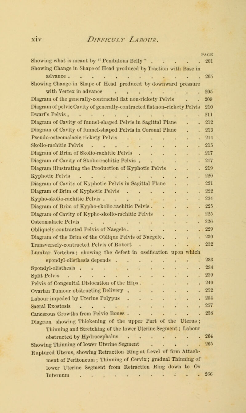 PAGE Showing what is meant by  Pendulous Belly  201 Showing Change in Shape of Head produced by Traction with Base in advance 205 Showing Change in Shape of Head produced by downward pressure with Vertex in advance 205 Diagram of the generally-contracted flat non-rickety Pelvis . . 209 Diagram of pelvic Cavity of generally-contracted flat non-rickety Pelvis 210 Dwarfs Pelvis 211 Diagram of Cavity of funnel-shaped Pelvis in Sagittal Plane . . 212 Diagram of Cavity of funnel-shaped Pelvis in Coronal Plane . . 213 Pseudo-osteomalacic rickety Pelvis 214 Skolio-rachitic Pelvis 215 Diagram of Brim of Skolio-rachitic Pelvis 217 Diagram of Cavity of Skolio-rachitic Pelvis 217 Diagram illustrating the Production of Kyphotic Pelvis . . . 219 Kyphotic Pelvis 220 Diagram of Cavity of Kyphotic Pelvis in Sagittal Plane . . . 221 Diagram of Brim of Kyphotic Pelvis 222 Kypho-skolio-rachitic Pelvis 224 Diagram of Brim of Kypho-skolio-rachitic Pelvis 225 Diagram of Cavity of Kypho-skolio-rachitic Pelvis .... 225 Osteomalacic Pelvis 226 Obliquely-contracted Pelvis of Xaegele 229 Diagram of the Brim of the Oblique Pelvis of Xaegele . . . .230 Transversely-contracted Pelvis of Robert 232 Lumbar Vertebra : showing the defect in ossification upon which spondylolisthesis depends 233 Spondylolisthesis 234 Split Pelvis . . 239 Pelvis of Congenital Dislocation of the Hips 240 Ovarian Tumour obstructing Delivery 252 Labour impeded by Uterine Polypus 254 Sacral Exostosis 257 Cancerous Growths from Pelvic Bones 258 Diagram showing Thickening of the upper Part of the Uterus ; Thinning and Stretching of the lower Uterine Segment; Labour obstructed by Hydrocephalus 264 Showing Thinning of lower Uterine Segment 265 Ruptured Uterus, showing Retraction Ring at Level of firm Attach- ment of Peritoneum ; Thinning of Cervix ; gradual Thinning of lower Uterine Segment from Retraction Ring down to Os Internum 266