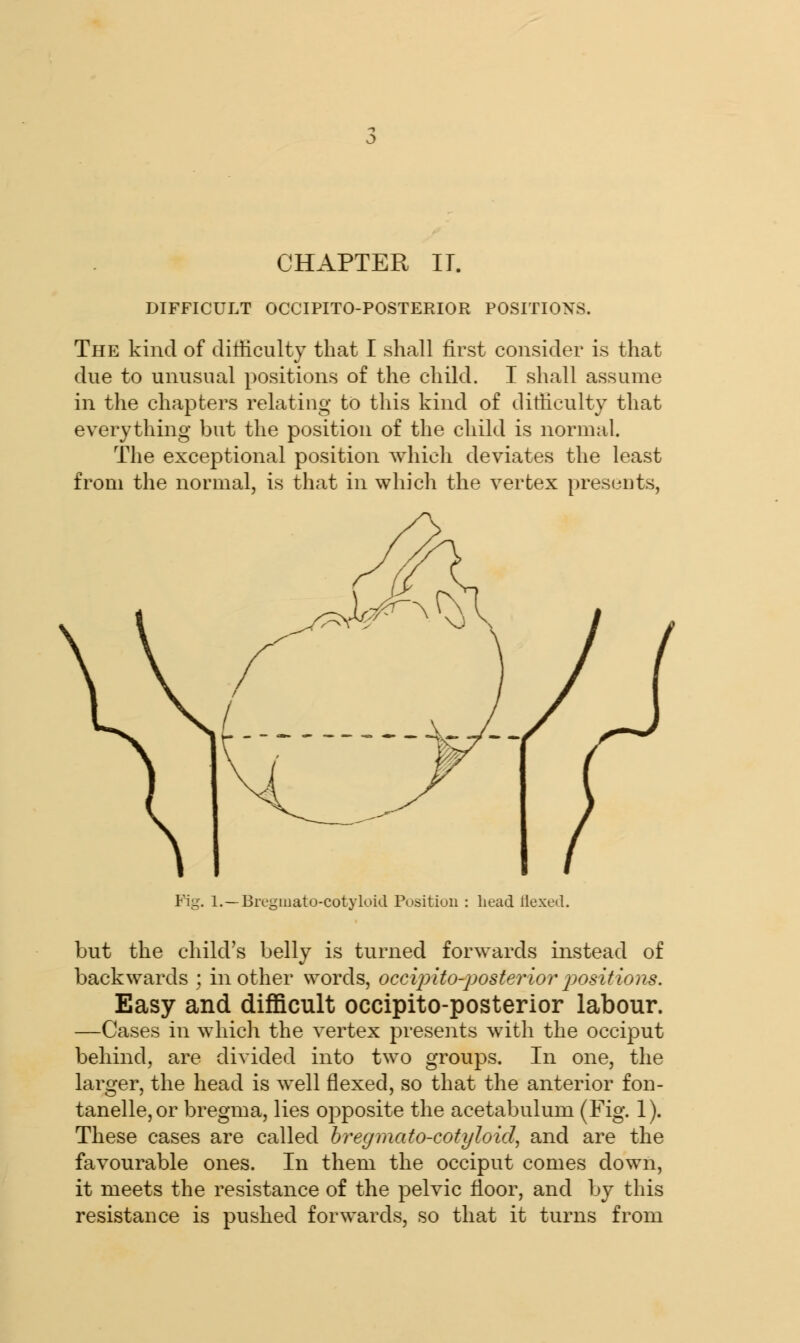 CHAPTER IT. DIFFICULT OCCIPITO-POSTERIOR POSITIONS. The kind of difficulty that I shall first consider is that due to unusual positions of the child. I shall assume in the chapters relating to this kind of difficulty that everything but the position of the child is normal. The exceptional position which deviates the least from the normal, is that in which the vertex presents, Fig. 1.—Bregmato-cotyloid Position : head Hexed. but the child's belly is turned forwards instead of backwards ; in other words, occiplto-posterior positions. Easy and difficult occipito-posterior labour. —Cases in which the vertex presents with the occiput behind, are divided into two groups. In one, the larger, the head is well flexed, so that the anterior fon- tanelle,or bregma, lies opposite the acetabulum (Fig. 1). These cases are called bregmato-cotyloid, and are the favourable ones. In them the occiput comes down, it meets the resistance of the pelvic floor, and by this resistance is pushed forwards, so that it turns from