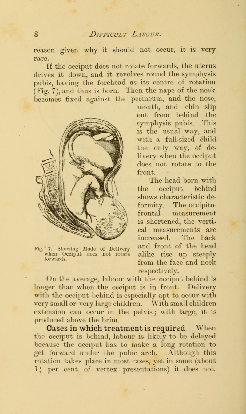 reason given why it should not occur, it is very rare. If the occiput does not rotate forwards, the uterus drives it down, and it revolves round the symphysis pubis, having the forehead as its centre of rotation (Fig. 7), and thus is born. Then the nape of the neck becomes fixed against the perineum, and the nose, mouth, and chin slip out from behind the symphysis pubis. This is the usual way, and with a full-sized child the only way, of de- livery when the occiput does not rotate to the front. The head born with the occiput behind shows characteristic de- formity. The occipito- frontal measurement is shortened, the verti- cal measurements are increased. The back and front of the head alike rise up steeply from the face and neck respectively. On the average, labour with the occiput behind is longer than when the occiput is in front. Delivery with the occiput behind is especially apt to occur with very small or very large children. With small children extension can occur in the pelvis; with large, it is produced above the brim. Cases in which treatment is required. -When the occiput is behind, labour is likely to be delayed because the occiput has to make a long rotation to get forward under the pubic arch. Although this rotation takes place in most cases, yet in some (about 1} per cent, of vertex presentations) it does not. Fig.' 7.—Showing Mode of Delivery when Occiput does not rotate forwards.