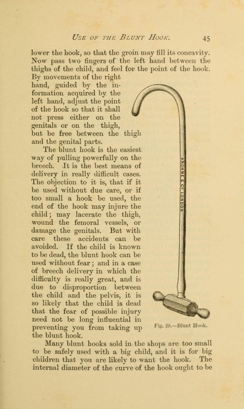 Use of the Blunt Hook. thisrh lower the hook, so that the groin may fill its concavity. Now pass two fingers of the left hand between the thighs of the child, and feel for the point of the hook. By movements of the right hand, guided by the in- formation acquired by the left hand, adjust the point of the hook so that it shall not press either on the genitals or on the thigh, but be free between the and the genital parts. The blunt hook is the easiest way of pulling powerfully on the breech. It is the best means of delivery in really difficult cases. The objection to it is, that if it be used without due care, or if too small a hook be used, the end of the hook may injure the child; may lacerate the thigh, wound the femoral vessels, or damage the genitals. But with care these accidents can be avoided. If the child is known to be dead, the blunt hook can be used without fear; and in a case of breech delivery in which the difficulty is really great, and is due to disproportion between the child and the pelvis, it is so likely that the child is dead that the fear of possible injury need not be long influential in preventing you from taking up the blunt hook. Many blunt hooks sold in the shops are too small to be safely used with a big child, and it is for big children that you are likely to want the hook. The internal diameter of the curve of the hook ought to be Fig. 29.—Blunt Hook.