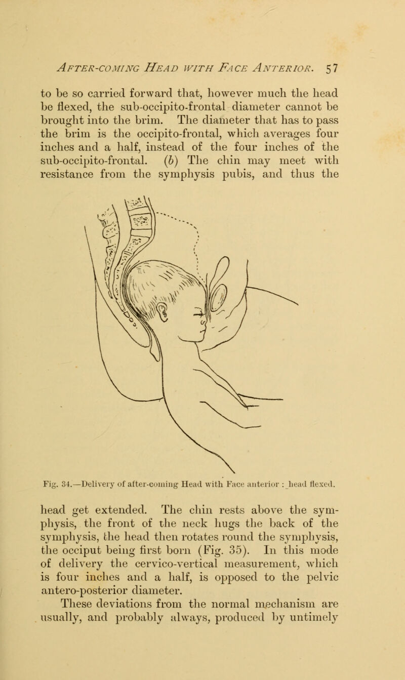 to be so carried forward that, however much the head be flexed, the sub-occipito-frontal diameter cannot be brought into the brim. The diameter that has to pass the brim is the occipitofrontal, which averages four inches and a half, instead of the four inches of the sub-occipito-frontal. (b) The chin may meet with resistance from the symphysis pubis, and thus the Fig. 34.—Delivery of after-coming Head with Face anterior : head flexed. head get extended. The chin rests above the sym- physis, the front of the neck hugs the back of the symphysis, the head then rotates round the symphysis, the occiput being first born (Fig. 35). In this mode of delivery the cervico-vertical measurement; which is four inches and a half, is opposed to the pelvic antero-posterior diameter. These deviations from the normal mechanism are usually, and probably always, produced by untimely