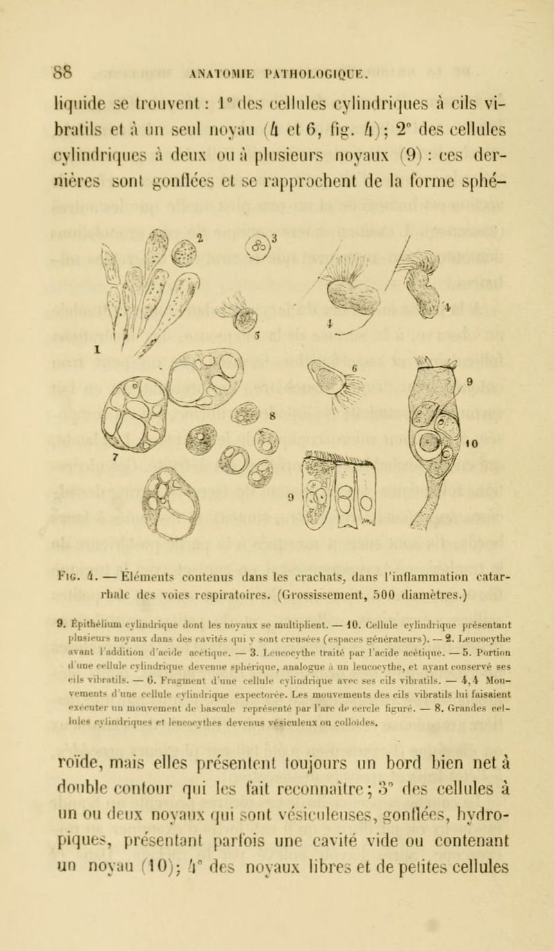 liquide se trouvenl : L°des cellules cylindriques à cils vi- brants et à un seul noyau /i el 6, fig. /|i; 2° des cellules cylindriques à deux ou à plusieurs noyaux (9): ces der- nières sonl gonflées el se rapprochent île la forme sphé- l-'n.. I. — Éléments contenus dans les crachats, dans l'inflammation catar- rbalt des voies respiratoires. (Grossissement, >00 diamètres.) 9. Éphhélium <• vIiii.Ii i.pie dont les noyaux se multiplient. — 10. Cellule cylindrique présentant plusieurs noyau dans 'i>-~ cavités qui \ sont creusées (espaces générateurs). — 2. Leucocythe avant I addition d'acide acétique. — 3. Leucocythe traité par l'acide acétique. —5. Portion il une cellule cylindrique devenue sphérique, analogue ù un leucocythe, >■! ayant conse eus vibratils.— G. Fragment d'i «Unie cylindrique avec ses cils vibratils. — i,\ Hon- •k .-m.-mt- .1 un.- cellule cylindrique expectorée. Les mouvements des cils vibratils lui faisaient Bter nu mouvement de bascule représenté par l'arc de cercle figuré. — 8. Grandes cel- lules cyiindi jrtbes devenus vésicnlenx on coll roïde, m:iis elles présentent toujours un bord bien net à double contour qui les fait reconnaître ; 3° (\f> cellules à un ou deux noyaux qui sonl vésiculeuses, gonflées, hydro- piques, présentant |>;ulois une cavité vide ou contenant un noy;m flO); d° des noyaux libres et de petites cellules