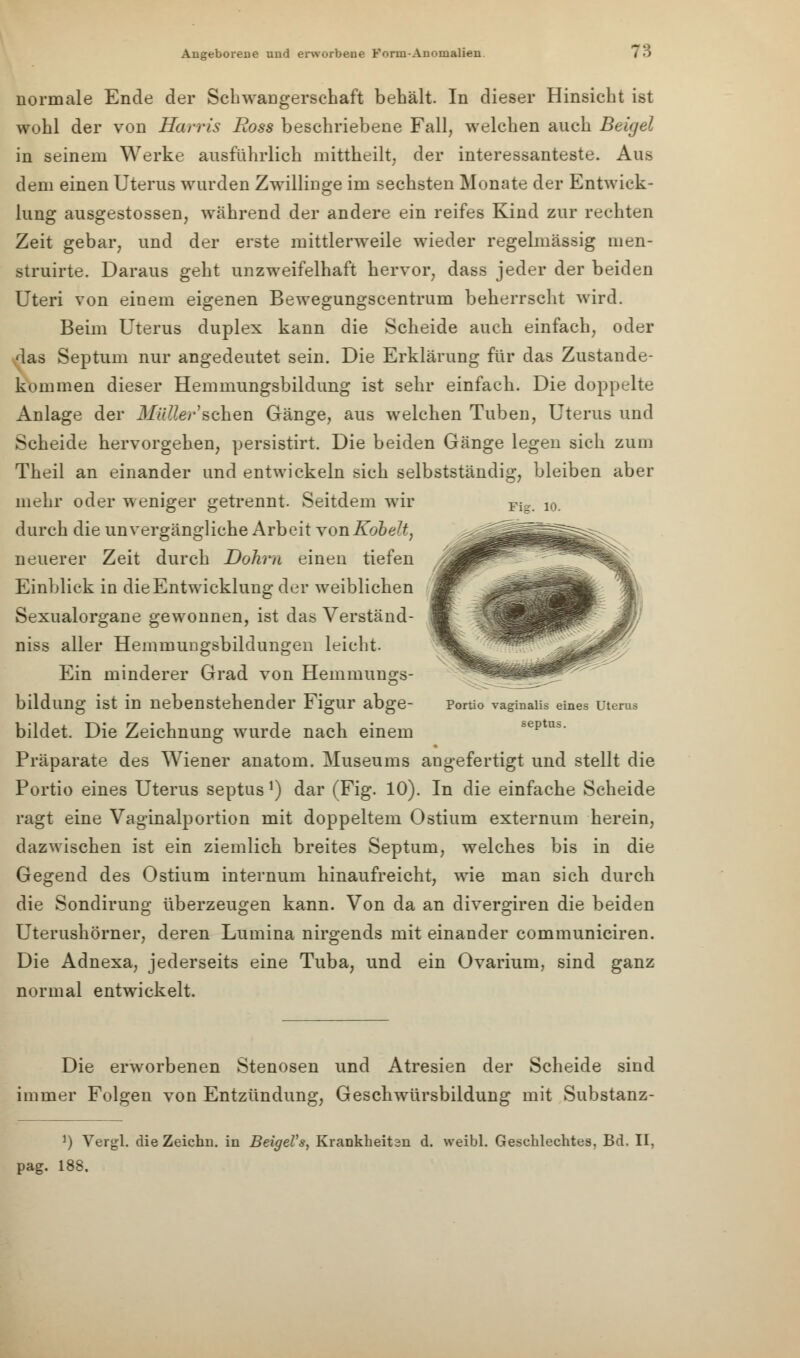 normale Ende der Schwangerschaft behält. In dieser Hinsicht ist wohl der von Harris Boss beschriebene Fall, welchen auch Beigel in seinem Werke ausführlich mittheilt, der interessanteste. Aus dem einen Uterus wurden Zwillinge im sechsten Monate der Entwick- lung ausgestossen, während der andere ein reifes Kind zur rechten Zeit gebar, und der erste mittlerweile wieder regelmässig men- struirte. Daraus geht unzweifelhaft hervor, dass jeder der beiden Uteri von einem eigenen Bewegungscentrum beherrscht wird. Beim Uterus duplex kann die Scheide auch einfach, oder das Septum nur angedeutet sein. Die Erklärung für das Zustande- kommen dieser Hemmungsbildung ist sehr einfach. Die doppelte Anlage der Mütter sehen Gänge, aus welchen Tuben, Uterus und Scheide hervorgehen, persistirt. Die beiden Gänge legen sieh zum Theil an einander und entwickeln sich selbstständig, bleiben aber mehr oder weniger getrennt. Seitdem wir Fig> 10_ durch die unvergängliche Arbeit YonKohelt, neuerer Zeit durch Dohrn einen tiefen Einblick in die Entwicklung der weiblichen Sexualorgane gewonnen, ist das Verständ- niss aller Hemmungsbildungen leicht. Ein minderer Grad von Hemmungs- bildung ist in nebenstehender Figur abge- Portio vaginalis eines utems bildet. Die Zeichnung wurde nach einem septus. Präparate des Wiener anatom. Museums angefertigt und stellt die Portio eines Uterus septas !) dar (Fig. 10). In die einfache Scheide ragt eine Vaginalportion mit doppeltem Ostium externum herein, dazwischen ist ein ziemlich breites Septum, welches bis in die Gegend des Ostium internum hinaufreicht, wie man sich durch die Sondirung überzeugen kann. Von da an divergiren die beiden Uterushörner, deren Lumina nirgends mit einander communiciren. Die Adnexa, jederseits eine Tuba, und ein Ovarium, sind ganz normal entwickelt. Die erworbenen Stenosen und Atresien der Scheide sind immer Folgen von Entzündung, Geschwürsbildung mit Substanz- J) Vergl. die Zeichn. in BeigeVs, Krankheiten d. weibl. Geschlechtes, Bd, II, pag. 188.