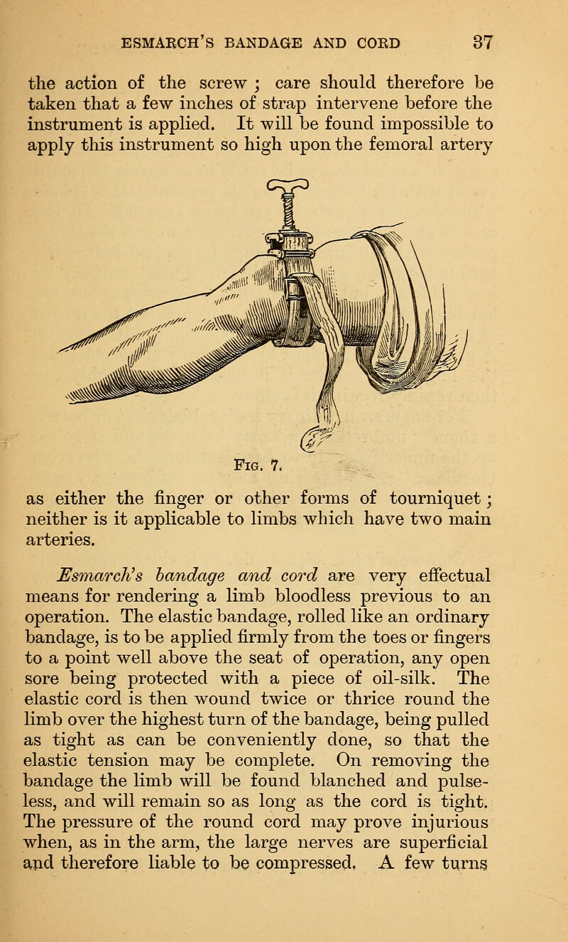 the action of the screw ; care should therefore be taken that a few inches of strap intervene before the instrument is applied. It will be found impossible to apply this instrument so high upon the femoral artery Fig. 7. as either the finger or other forms of tourniquet; neither is it applicable to limbs which have two main arteries. EsmarcNs bandage and cord are very effectual means for rendering a limb bloodless previous to an operation. The elastic bandage, rolled like an ordinary bandage, is to be applied firmly from the toes or fingers to a point well above the seat of operation, any open sore being protected with a piece of oil-silk. The elastic cord is then wound twice or thrice round the limb over the highest turn of the bandage, being pulled as tight as can be conveniently done, so that the elastic tension may be complete. On removing the bandage the limb will be found blanched and pulse- less, and will remain so as long as the cord is tight. The pressure of the round cord may prove injurious when, as in the arm, the large nerves are superficial and therefore liable to be compressed, A few turns