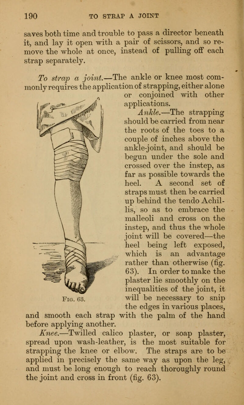 saves both time and trouble to pass a director beneath it, and lay it open with a pair of scissors, and so re- move the whole at once, instead of pulling off each strap separately. To strap a joint.—The ankle or knee most com- monly requires the application of strapping, either alone ^ or conjoined with other applications. Ankle.—The strapping should be carried from near the roots of the toes to a couple of inches above the ankle-joint, and should be besfun under the sole and crossed over the instep, as far as possible towards the heel. A second set of straps must then be carried up behind the tendo Achil- lis, so as to embrace the malleoli and cross on the instep, and thus the whole joint will be covered—the heel being left exposed, , which is an advantage rather than otherwise (fig. 63). In order to make the plaster lie smoothly on the inequalities of the joint, it Fig. 63. will be necessary to snip the edges in various places, and smooth each strap with the palm of the hand before applying another. Knee.—Twilled calico plaster, or soap plaster, spread upon wash-leather, is the most suitable for strapping the knee or elbow. The straps are to be applied in precisely the same way as upon the leg, and must be long enough to reach thorouglily round the joint and cross in front (fig. 63).