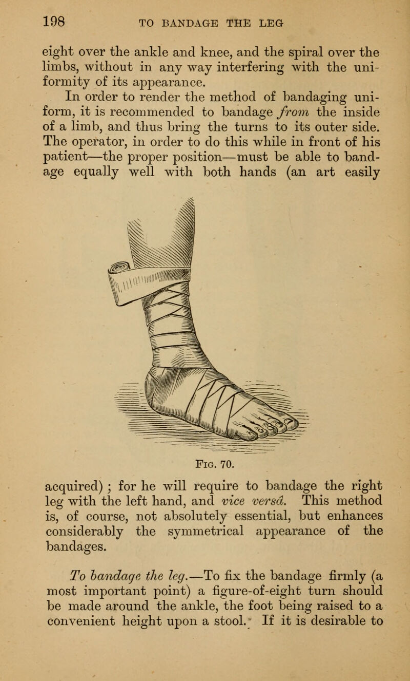 eight over the ankle and knee, and the spiral over the limbs, without in any way interfering with the uni- formity of its appearance. In order to render the metliod of bandaging uni- form, it is recommended to bandage froin the inside of a limb, and thus bring the turns to its outer side. The operator, in order to do this while in front of his patient—the proper position—must be able to band- age equally well with both hands (an art easily Fig. 70. acquired) ; for he will require to bandage the right leg with the left hand, and vice versa. This method is, of course, not absolutely essential, but enhances considerably the symmetrical appearance of the bandages. To bandage the leg.—To fix the bandage firmly (a most important point) a figure-of-eight turn should be made around the ankle, the foot being raised to a convenient height upon a stool.; If it is desirable to