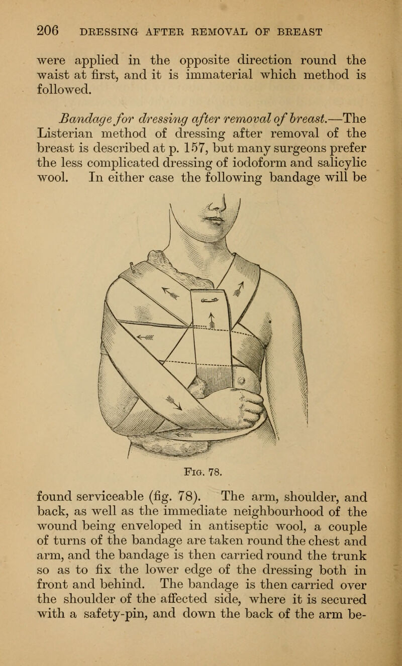 were applied in the opposite direction round the waist at first, and it is immaterial which method is followed. Bandage for dressi7ig after rer^ioval of breast.—The Listerian method of dressing after removal of the breast is described at p. 157, but many surgeons prefer the less complicated dressing of iodoform and salicylic wool. In either case the following bandage will be Fig. 78. found serviceable (fig. 78). The arm, shoulder, and back, as well as the immediate neighbourhood of the wound being enveloped in antiseptic wool, a couple of turns of the bandage are taken round the chest and arm, and the bandage is then carried round the trunk so as to fix the lower edge of the dressing both in front and behind. The bandage is then carried over the shoulder of the affected side, where it is secured with a safety-pin, and down the back of the arm be-