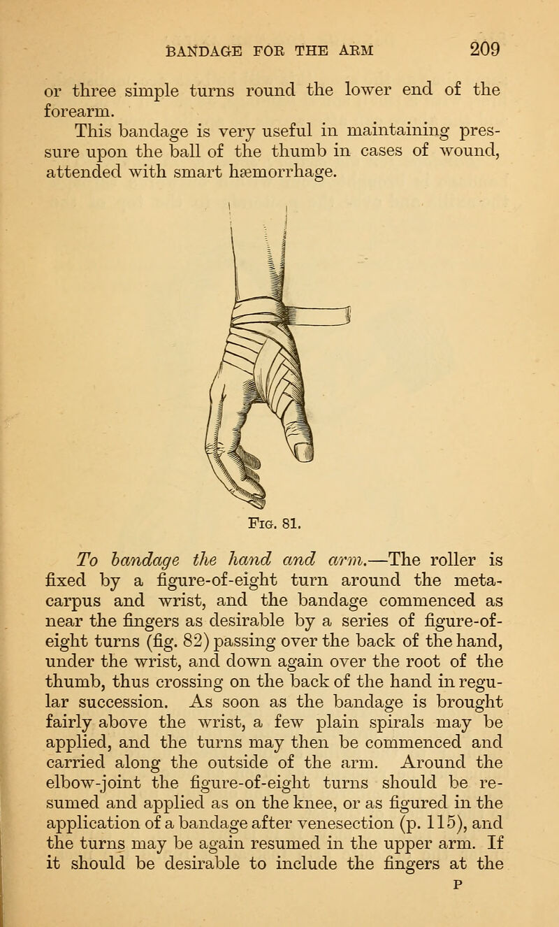 or three simple turns round the lower end of the forearm. This bandage is very useful in maintaining pres- sure upon the ball of the thumb in cases of wound, attended with smart haemorrhage. Fig. 81. To bandage the hand and arm.—The roller is fixed by a figure-of-eight turn around the meta- carpus and wrist, and the bandage commenced as near the fingers as desirable by a series of figure-of- eight turns (fig. 82) passing over the back of the hand, under the wrist, and down again over the root of the thumb, thus crossing on the back of the hand in regu- lar succession. As soon as the bandage is brought fairly above the wrist, a few plain spirals may be applied, and the turns may then be commenced and carried along the outside of the arm. Around the elbow-joint the figure-of-eight turns should be re- sumed and applied as on the knee, or as figured in the application of a bandage after venesection (p. 115), and the turns may be again resumed in the upper arm. If it should be desirable to include the fingers at the