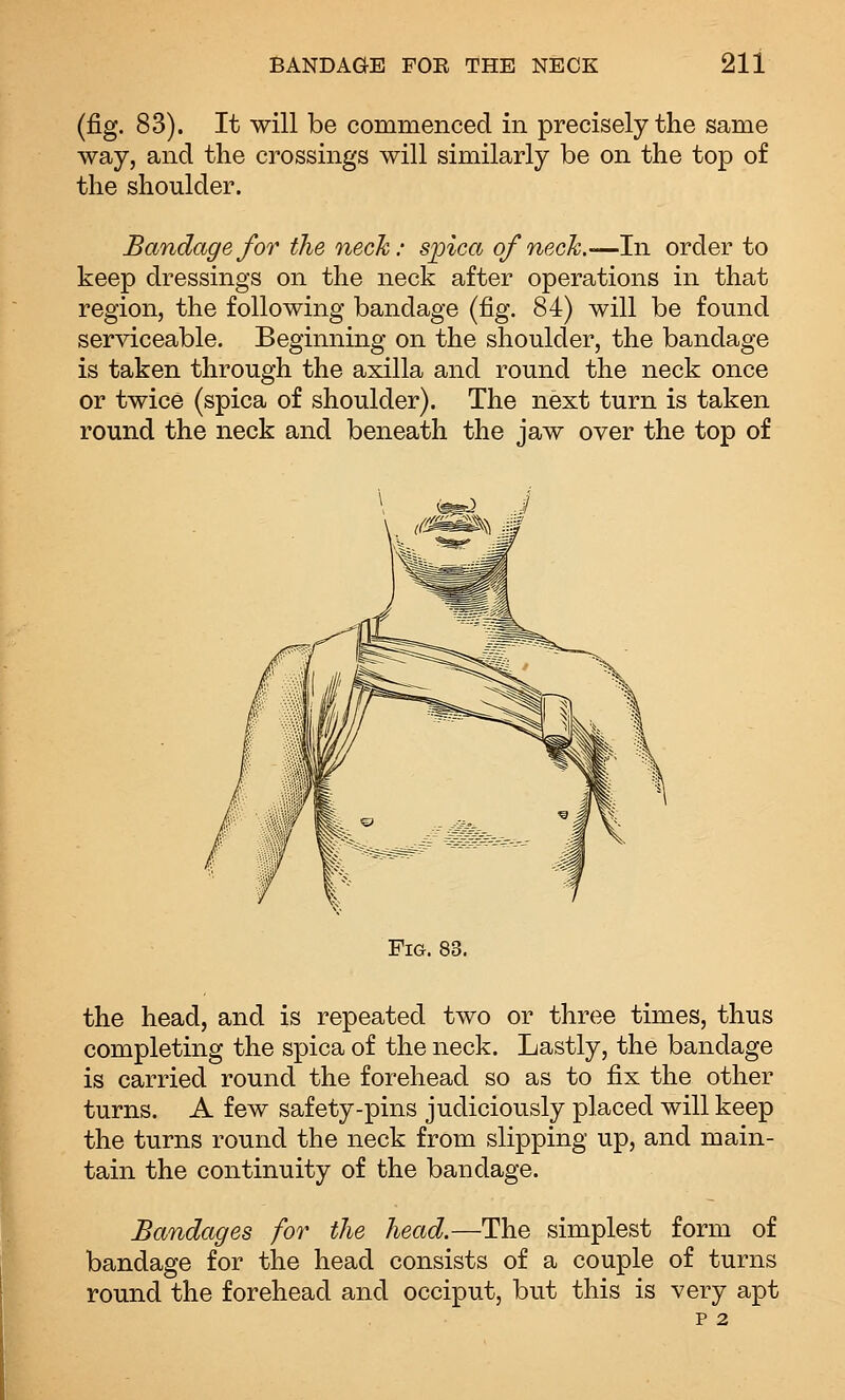 (fig. 83). It will be commenced in precisely the same way, and the crossings will similarly be on the top of the shoulder. Bandage for the neck: sjjica of neck.—In order to keep dressings on the neck after operations in that region, the following bandage (fig. 84) will be found serviceable. Beginning on the shoulder, the bandage is taken through the axilla and round the neck once or twice (spica of shoulder). The next turn is taken round the neck and beneath the jaw over the top of Fig. 83. the head, and is repeated two or three times, thus completing the spica of the neck. Lastly, the bandage is carried round the forehead so as to fix the other turns. A few safety-pins judiciously placed will keep the turns round the neck from slipping up, and main- tain the continuity of the bandage. Bandages for the head.—The simplest form of bandage for the head consists of a couple of turns round the forehead and occiput, but this is very apt P 2