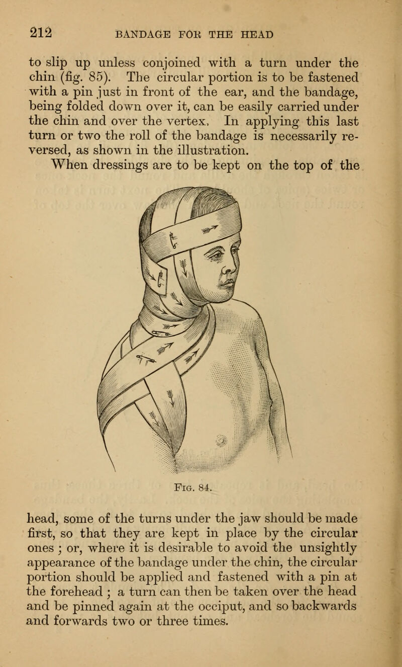 to slip up unless conjoined with a turn under the chin (fig. 85). The circular portion is to be fastened with a pin just in front of the ear, and the bandage, being folded down over it, can be easily carried under the chin and over the vertex. In applying this last turn or two the roll of the bandage is necessarily re- versed, as shown in the illustration. When dressings are to be kept on the top of the Fig. «4. head, some of the turns under the jaw should be made first, so that they are kept in place by the circular ones ; or, where it is desirable to avoid the unsightly appearance of the bandage under the chin, the circular portion should be applied and fastened with a pin at the forehead ; a turn can then be taken over the head and be pinned again at the occiput, and so backwards and forwards two or three times.