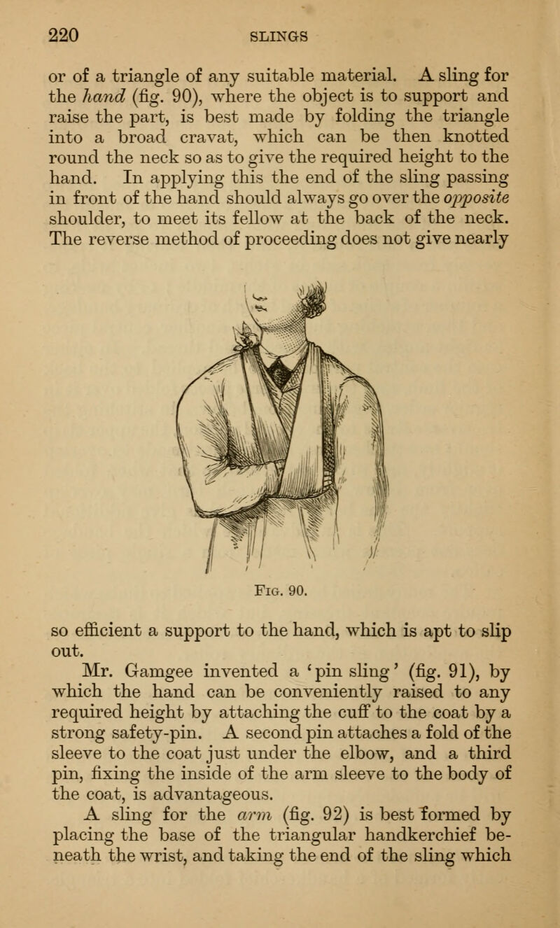 or of a triangle of any suitable material. A sling for the hand (fig. 90), where the object is to support and raise the part, is best made by folding the triangle into a broad cravat, which can be then knotted round the neck so as to give the required height to the hand. In applying this the end of the sling passing in front of the hand should always go over the ojyposite shoulder, to meet its fellow at the back of the neck. The reverse method of proceeding does not give nearly Fig. 90. so efficient a support to the hand, which is apt to slip out. Mr. Gamgee invented a 'pin sling' (fig. 91), by which the hand can be conveniently raised to any required height by attaching the cuff to the coat by a strong safety-pin. A second pin attaches a fold of the sleeve to the coat just under the elbow, and a third pin, fixing the inside of the arm sleeve to the body of the coat, is advantageous. A sling for the arm (fig. 92) is best formed by placing the base of the triangular handkerchief be- neath the wrist, and taking the end of the sling which