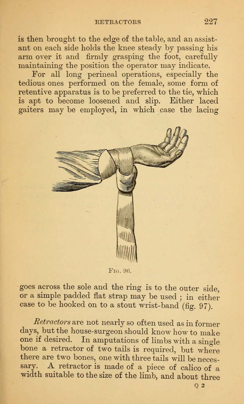 is then brought to the edge of the table, and an assist- ant on each side holds the knee steady by passing his arm over it and firmly grasping the foot, carefully maintaining the position the operator may indicate. For all long perineal operations, especially the tedious ones performed on the female, some form of retentive apparatus is to be preferred to the tie, which is apt to become loosened and slip. Either laced gaiters may be employed, in which case the lacing Fig. 96. ■ goes across the sole and the ring is to the outer side, or a simple padded flat strap may be used ; in either case to be hooked on to a stout wrist-band (fig. 97). Retractors are not nearly so often used as in former days, but the house-surgeon should know how to make one if desired. In amputations of limbs ^vith a sino-le bone a retractor of two tails is required, but where there are two bones, one with three tails will be neces- sary. A retractor is made of a piece of calico of a width suitable to the size of the limb, and about three Q 2