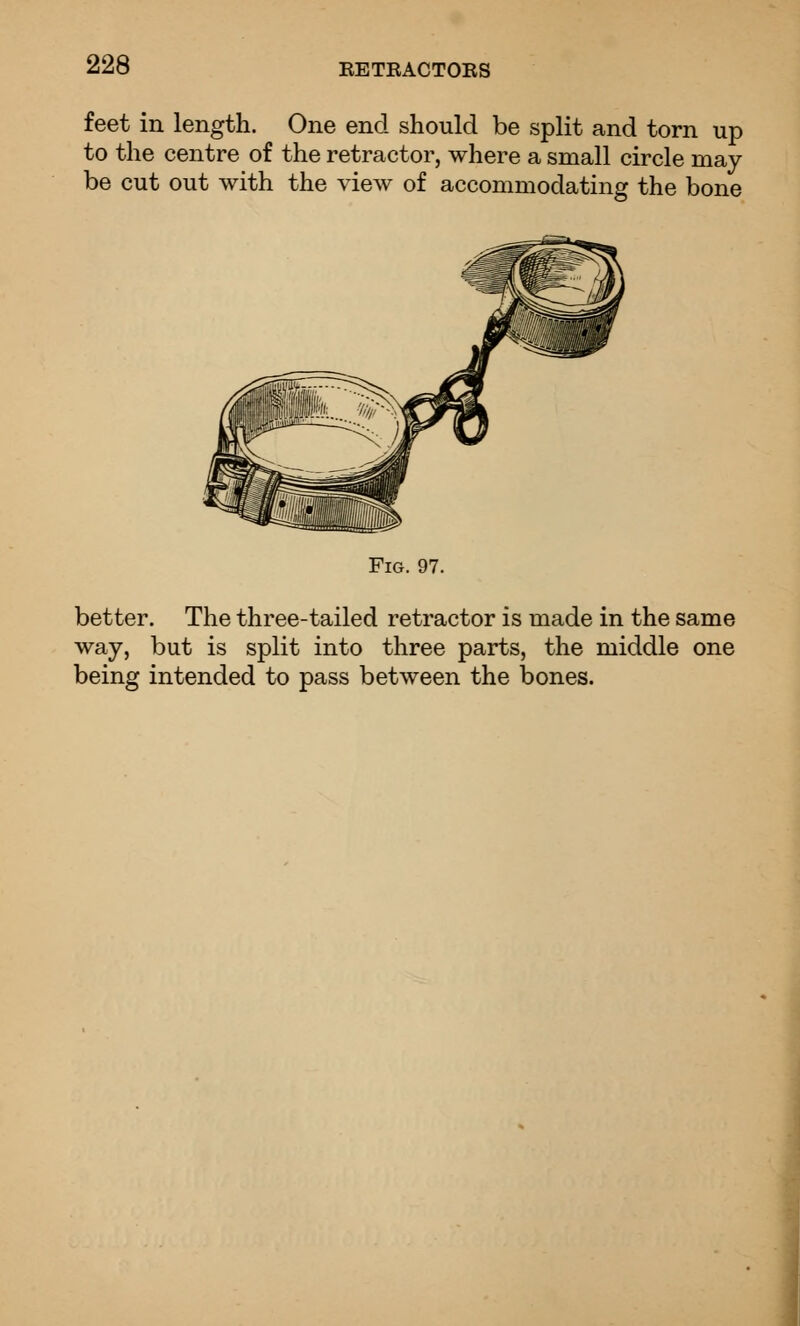 feet in length. One end should be split and torn up to the centre of the retractor, where a small circle may be cut out with the view of accommodating the bone Fig. 97. better. The three-tailed retractor is made in the same way, but is split into three parts, the middle one being intended to pass between the bones. '-A