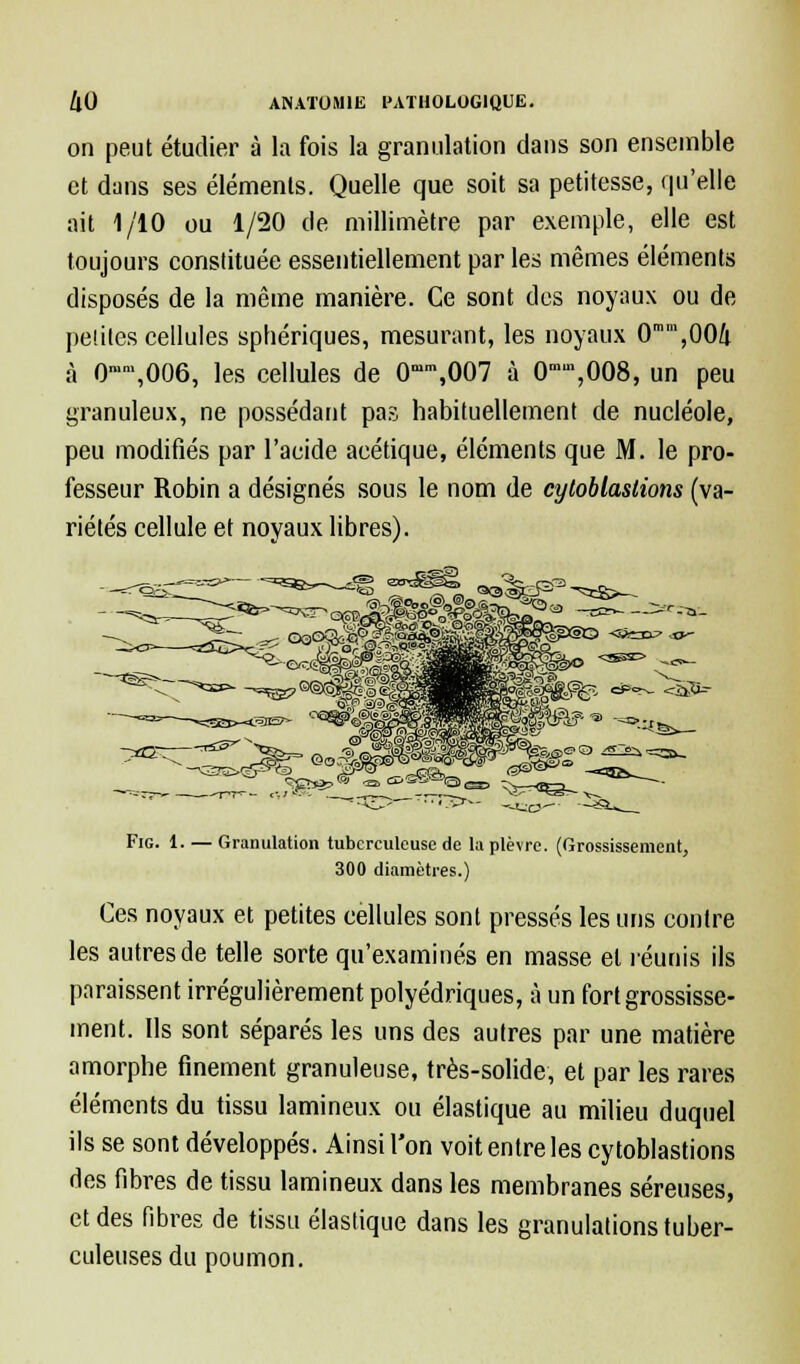 on peut étudier à la fois la granulation dans son ensemble et dans ses éléments. Quelle que soit sa petitesse, qu'elle ait 1/10 ou 1/20 de millimètre par exemple, elle est toujours constituée essentiellement par les mêmes éléments disposés de la même manière. Ce sont des noyaux ou de petites cellules sphériques, mesurant, les noyaux 0°,00!i à 0n,n',006, les cellules de 0mm,007 à 0,008, un peu granuleux, ne possédant pas habituellement de nucléole, peu modifiés par l'acide acétique, éléments que M. le pro- fesseur Robin a désignés sous le nom de cyloblaslions (va- riétés cellule et noyaux libres). Fig. 1. — Granulation tuberculeuse de la plèvre. (Grossissement, 300 diamètres.) Ces noyaux et petites cellules sont pressés les uns contre les autres de telle sorte qu'examinés en masse et réunis ils paraissent irrégulièrement polyédriques, à un fort grossisse- ment. Ils sont séparés les uns des autres par une matière amorphe finement granuleuse, très-solide, et par les rares éléments du tissu lamineux ou élastique au milieu duquel ils se sont développés. Ainsi l'on voit entre les cytoblastions des fibres de tissu lamineux dans les membranes séreuses, et des fibres de tissu élastique dans les granulations tuber- culeuses du poumon.