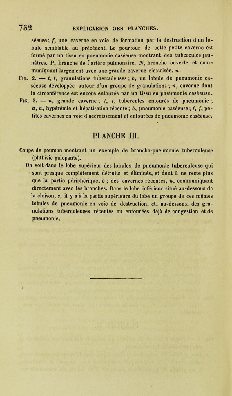 séeuse ; f, une caverne en voie de formation par la destruction d'un lo- bule semblable au précédent. Le pourtour de cette petite caverne est formé par un tissu en pneumonie caséeuse montrant des tubercules jau- nâtres. P, branche de Tarière pulmonaire. N, bronche ouverte et com- muniquant largement avec une grande caverne cicatrisée, ». Fig. 2. — (, t, granulations tuberculeuses ; 6, un lobule de pneumonie ca- séeuse développée autour d'un groupe de granulations ; n, caverne dont la circonférence est encore entourée par un tissu en pneumonie caséeuse. Fie. 3. — n, grande caverne ; /, t, tubercules entourés de pneumonie ; a, a, hypérémie et hépatisationrécente ; b, pneumonie caséeuse; f, f, pe- tites cavernes en voie d'accroissement et entourées de pneumonie caséeuse. PLANCHE III. Coupe de poumon montrant un exemple de broncho-pneumonie tuberculeuse (phthisie galopante). On voit dans le lobe supérieur des lobules de pneumonie tuberculeuse qui sont presque complètement détruits et éliminés, et dont il ne reste plus que la partie périphérique, 6 ; des cavernes récentes, n, communiquant directement avec les bronches. Dans le lobe inférieur situé au-dessous de la cloison, s, il y a à la partie supérieure du lobe un groupe de ces mêmes lobules de pneumonie en voie de destruction, et, au-dessous, des gra- nulations tuberculeuses récentes ou entourées déjà de congestion et de pneumonie.