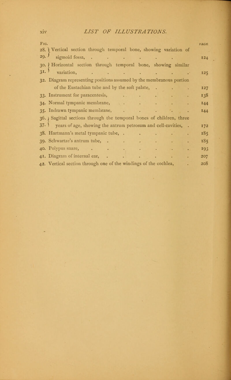 Fig 28. 29. 30. 31- 32. 33- 34- 35- 36. 37- 38. 39- 40. 41. 42. \ Vertical section through temporal bone, showing variation of J sigmoid fossa, ...... Horizontal section through temporal bone, showing similar variation, ....... Diagram representing positions assumed by the membranous portion of the Eustachian tube and by the soft palate, Instrument for paracentesis, .... Normal tympanic membrane, . . . Indrawn tympanic membrane. .... ) Sagittal sections through the temporal bones of children, three ' years of age. showing the antrum petrosum and cell-cavities, Hartmann's metal tympanic tube, .... Schwartze's antrum tube, ..... Polypus snare, ...... Diagram of internal ear, ..... Vertical section through one of the windings of the cochlea, 124 125 127 133 144 144 172 185 1S5 193 207 208