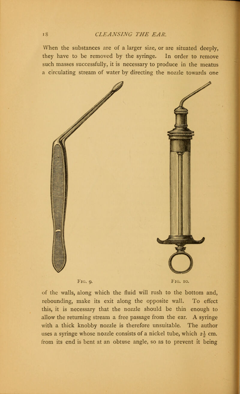 When the substances are of a larger size, or are situated deeply, they have to be removed by the syringe. In order to remove such masses successfully, it is necessary to produce in the meatus a circulating stream of water by directing the nozzle towards one Fig. 9. Fig. 10. of the walls, along which the fluid will rush to the bottom and, rebounding, make its exit along the opposite wall. To effect this, it is necessary that the nozzle should be thin enough to allow the returning stream a free passage from the ear. A syringe with a thick knobby nozzle is therefore unsuitable. The author uses a syringe whose nozzle consists of a nickel tube, which 2\ cm. from its end is bent at an obtuse angle, so as to prevent it being