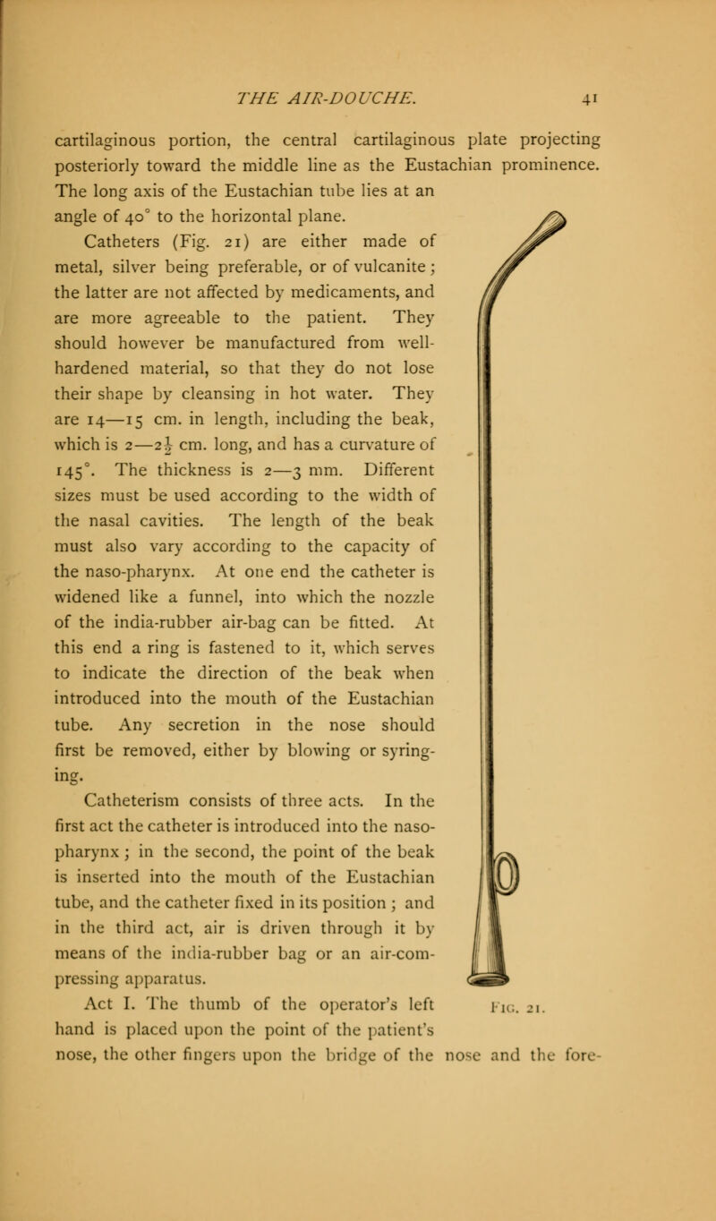 cartilaginous portion, the central cartilaginous plate projecting posteriorly toward the middle line as the Eustachian prominence. The long axis of the Eustachian tube lies at an angle of 400 to the horizontal plane. Catheters (Fig. 21) are either made of metal, silver being preferable, or of vulcanite ; the latter are not affected by medicaments, and are more agreeable to the patient. They should however be manufactured from well- hardened material, so that they do not lose their shape by cleansing in hot water. They are 14—15 cm. in length, including the beak, which is 2—2 J cm. long, and has a curvature of 1450. The thickness is 2—3 mm. Different sizes must be used according to the width of the nasal cavities. The length of the beak must also vary according to the capacity of the naso-pharynx. At one end the catheter is widened like a funnel, into which the nozzle of the india-rubber air-bag can be fitted. At this end a ring is fastened to it, which serves to indicate the direction of the beak when introduced into the mouth of the Eustachian tube. Any secretion in the nose should first be removed, either by blowing or syring- ing. Catheterism consists of three acts. In the first act the catheter is introduced into the naso- pharynx ; in the second, the point of the beak is inserted into the mouth of the Eustachian tube, and the catheter fixed in its position ; and in the third act, air is driven through it by means of the india-rubber bag or an air-com- pressing apparatus. Act I. The thumb of the operator's left hand is placed upon the point of the patient's nose, the other fingers upon the bridge of the nose and the fore Fig.
