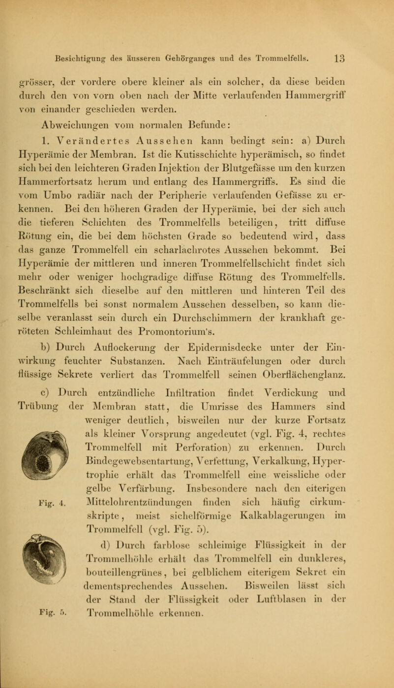 grösser, der vordere obere kleiner als ein solcher, da diese beiden durch den von vorn oben nacli der Mitte verlaufenden Hammergriff von einander geschieden werden. Abweichungen vom normalen Befunde: 1. Verändertes Aussehen kann bedingt sein: a) Durch Hyperämie der Membran. Ist die Kutisschichte hyperämisch, so hndet sich bei den leichteren Graden Injektion der Blutgefässe um den kurzen Hammerfortsatz herum und entlang des Hammergriffs. Es sind die vom Umbo radiär nach der Peripherie verlaufenden Gefässe zu er- kennen. Bei den höheren Graden der Hyperämie, bei der sich auch die tieferen Schichten des Trommelfells beteiligen, tritt diffuse Rötung ein, die bei dem höchsten Grade so bedeutend wird, dass das ganze Trommelfell ein scharlachrotes Aussehen bekommt. Bei Hyperämie der mittleren und inneren Trommelfellschicht rindet sich mehr oder weniger hochgradige diffuse Rötung des Trommelfells. Beschränkt sich dieselbe auf den mittleren und hinteren Teil des Trommelfells bei sonst normalem Aussehen desselben, so kann die- selbe veranlasst sein durch ein Durchschimmern der krankhaft ge- röteten Schleimhaut des Promontorium's. b) Durch Auflockerung der Epiderinisdecke unter der Ein- wirkung feuchter Substanzen. Nach Einträufelungen oder durch flüssige Sekrete verliert das Trommelfell seinen Oberflächenglanz. c) Durch entzündliche Infiltration findet Verdickung und Trübung der Membran statt, die Umrisse des Hammers sind weniger deutlich, bisweilen nur der kurze Fortsatz als kleiner Vorsprung angedeutet (vgl. Fig. 4, rechtes Trommelfell mit Perforation) zu erkennen. Durch Bindegewebsentartung, Verfettung, Verkalkung, Hyper- trophie erhält das Trommelfell eine weissliche oder gelbe Verfärbung. Insbesondere nach den eiterigen Fig. i. Mittelohrentzündungen finden sieh häufig eirkiim- skripte, meist sichelförmige Kalkablagerangen im Trommelfell (vgl. Fig. 5). d) Durch farblose Bchleimige Flüssigkeil in der Trommelhöhle erhält das Trommelfell ein dunkleres, bouteillengrünes, bei gelblichem eiterigem Sekret ein dementsprechendes Aussehen. Bisweilen lässt öich der Stand dw Flüssigkeit der Luftblasen in der Fig. 5. Trommelhöhle erkennen.