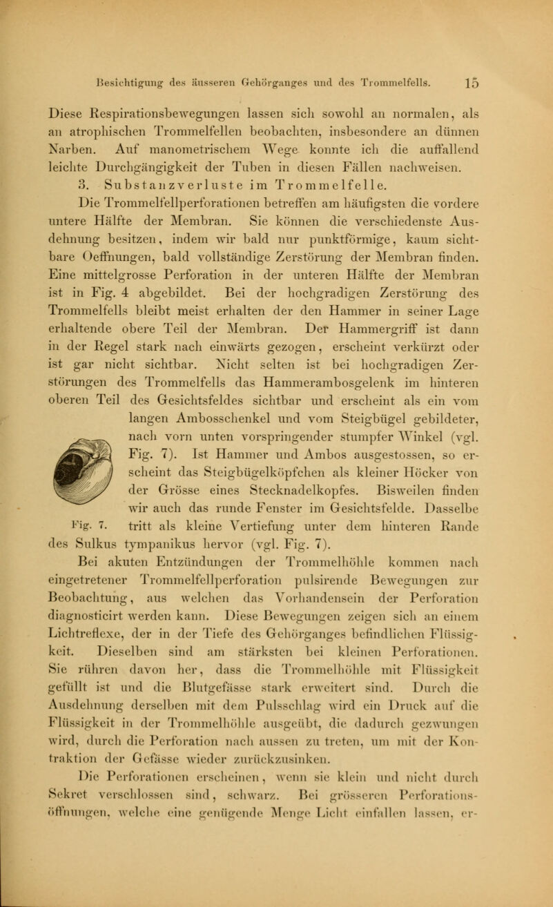 Diese Respirationsbewegungen lassen sich sowohl an normalen, als an atrophischen Trommelfellen beobachten, insbesondere an dünnen Narben. Auf manometrischem Wege konnte ich die auffallend leichte Durchgängigkeit der Tuben in diesen Fällen nachweisen. 3. Substanzverluste im Trommelfelle. Die Trommelfellperforationen betreffen am häufigsten die vordere untere Hälfte der Membran. Sie können die verschiedenste Aus- dehnung besitzen, indem wir bald nur punktförmige, kaum sicht- bare Oeffnungen, bald vollständige Zerstörung der Membran finden. Eine mittelgrosse Perforation in der unteren Hälfte der Membran ist in Fig. 4 abgebildet. Bei der hochgradigen Zerstörung des Trommelfells bleibt meist erhalten der den Hammer in seiner Lao-e o erhaltende obere Teil der Membran. Der Hammergriff ist dann in der Regel stark nach einwärts gezogen, erscheint verkürzt oder ist gar nicht sichtbar. Xicht selten ist bei hochgradigen Zer- störungen des Trommelfells das Hammerambosgelenk im hinteren oberen Teil des Gesichtsfeldes sichtbar und erscheint als ein vom langen Ambosschenkel und vom Steigbügel gebildeter, nacli vorn unten vorspringender stumpfer Winkel (vgl. Fig. 7). Ist Hammer und Ambos ausgestossen, so er- scheint das Steigbügelköpfchen als kleiner Höcker von der Grösse eines Stecknadelkopfes. Bisweilen finden wir auch das runde Fenster im Gesichtsfelde. Dasselbe Fig. 7. tritt als kleine Vertiefung unter dem hinteren Rande des Sulkus tympanikus hervor (vgl. Fig. 7). Bei akuten Entzündungen der Trommelhöhle kommen nach eingetretener Trommelfellperforation pulsirende Bewegungen zur Beobachtung, aus welchen das Vorhandensein der Perforation diagnosticirt werden kann. Diese Bewegungen zeigen sich an einem Lichtreflexe, der in der Tiefe des Gehörganges befindlichen Flüssig- keit. Dieselben sind am stärksten bei kleinen Perforationen. Sie rühren davon her, dass die Trommelhöhle mit Flüssigkeil gefüllt ist und die Blutgefässe stark erweitert sind. Durch die Ausdehnung derselben mit dem Pulsschlag wird ein Druck auf die Flüssigkeit in der Trommelhöhle ausgeübt, die dadurch gezwungen wird, durch die Perforation nach aussen zu treten, um mit der Kon traktion der Gefasse wieder zurückzusinken. Die Perforationen erscheinen, wenn sie klein und nicht durch Sekret verschlossen sind, schwarz. Bei grösseren Perforations- öffnungen, welche eine genügende Menge Lichl einfallen lassen, er-