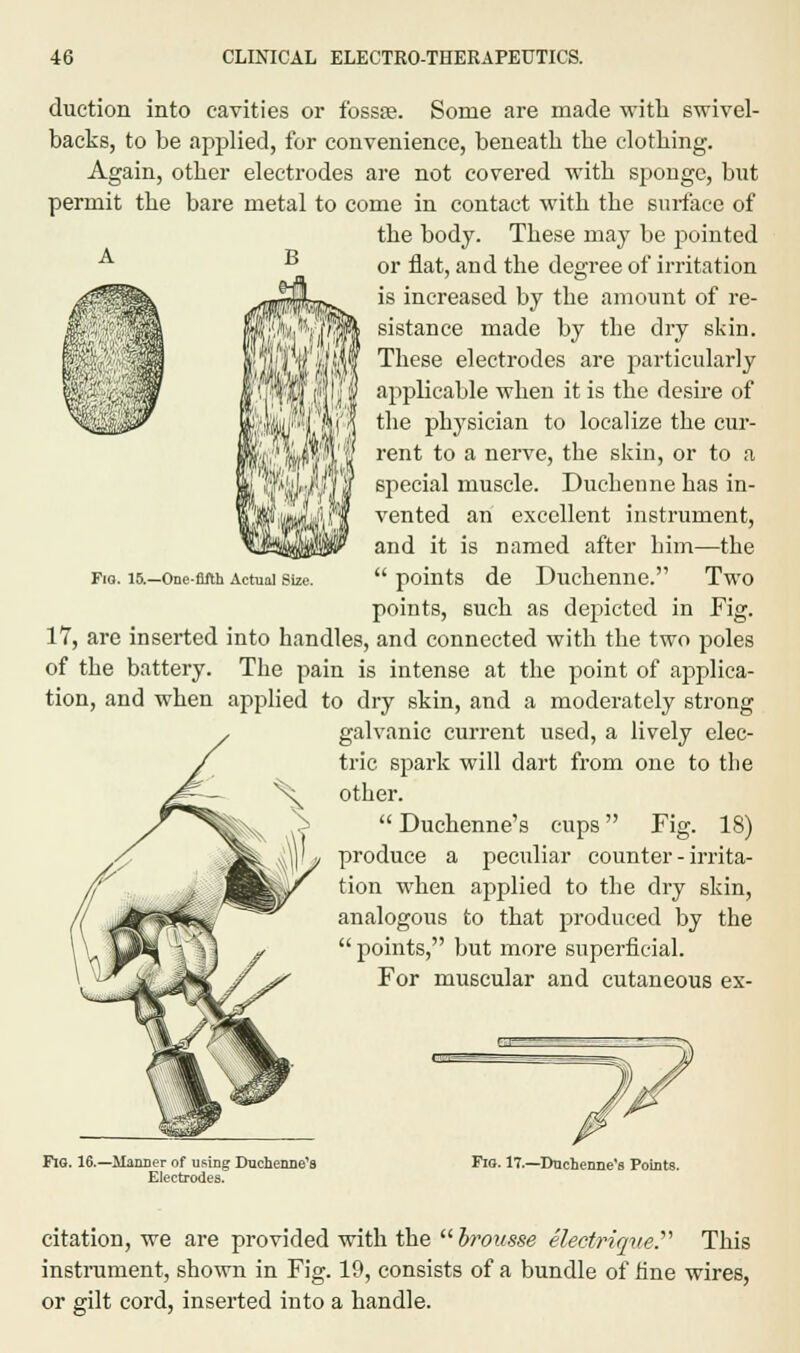 duction into cavities or fossse. Some are made with swivel- backs, to be applied, for convenience, beneath the clothing. Again, other electrodes are not covered with sponge, but permit the bare metal to come in contact with the surface of the body. These may be pointed or flat, and the degree of irritation is increased by the amount of re- sistance made by the dry skin. These electrodes are particularly applicable when it is the desire of the physician to localize the cur- rent to a nerve, the skin, or to a special muscle. Duchenne has in- vented an excellent instrument, and it is named after him—the  points de Duchenne. Two points, such as depicted in Fig. 17, are inserted into handles, and connected with the two poles of the battery. The pain is intense at the point of applica- tion, and when applied to dry skin, and a moderately strong galvanic current used, a lively elec- tric spark will dart from one to the other.  Duchenne's cups Fig. 18) produce a peculiar counter - irrita- tion when applied to the dry skin, analogous to that produced by the  points, but more superficial. For muscular and cutaneous ex- Fia. 15.—One-fifth Actual Size. Fig. 16.—Manner of using Duchenne's Electrodes. Fig. 17.—Duchenne's Points. citation, we are provided with the  brousse electriqueP This instrument, shown in Fig. 19, consists of a bundle of fine wires, or gilt cord, inserted into a handle.