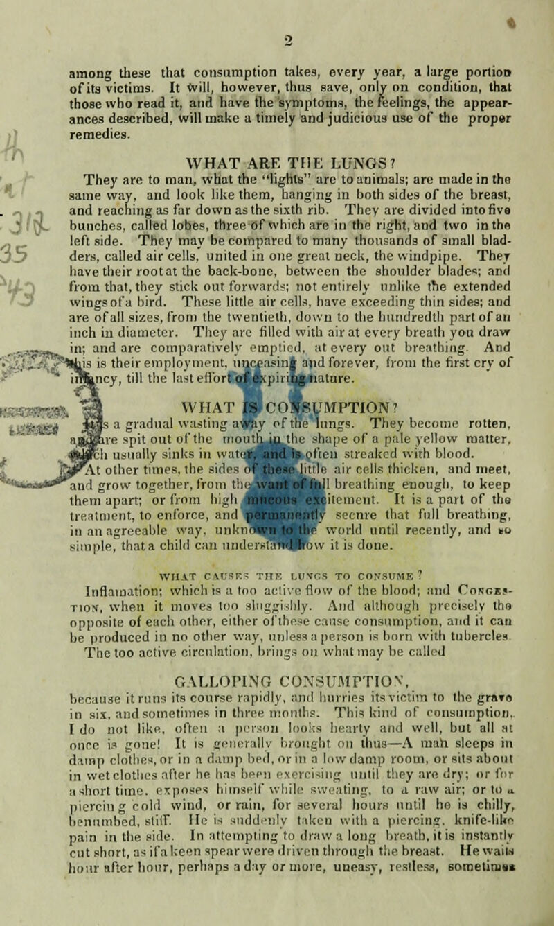 among these that consumption takes, every year, a large porlioD of its victims. It will, however, thus save, only on condition, that those who read it, and have the symptoms, the feelings, the appear- ances described, will make a timely and judicious use of the proper remedies. WHAT ARE THE LUNGS? They are to man, what the lights are to animals; are made in the same way, and look like them, hanging in both sides of the breast, and reaching as far down as the sixth rib. They are divided into five bunches, called lobes, three of which are in the right, and two in the left side. They may be compared to many thousands of small blad- ders, called air cells, united in one great ueck, the windpipe. They have their root at the back-bone, between the shoulder blades; and from that, they stick out forwards; not entirely unlike the extended wings of a bird. These little air cells, have exceeding thin sides; and are of all sizes, from the twentieth, down to the hundredth part of an inch m diameter. They are filled with air at every breath you draw in; and are comparatively emptied, at every out breathing. And their employment, unceasint aiid forever, from the first cry of ncy, till the last en'orKaafpirinnatnre. WHAT BcOMJUMPTION? a gradual wasting ajjiy of the lungs. They become rotten, e spit out of the moutlij^he shape of a pale yellow matter, 1 usually sinks in wat other tunes, the sides grow together, from t! them apart; or from high treatment, to enforce, and in an agreeable way. unk simple, that a child can uml and ; ►often streaked with blood. kittle air cells thicken, and meet, Jl breathing enough, to keep ^pitement. It is a part of ths L'cnre that full breathing, world until recently, and ko it is done. WHAT CAUSES THE LUtfCS TO CONSUME? Inflamation; which is a too active flow of the blood; and Cougbs- tion, when it moves loo sluggishly. And although precisely the opposite of each other, either ofthese cause consumption, and it can be produced in no other way, unless a person is born with tubercles The too active circulation, brings on what may be called GALLOPING CONSUMPTION', because it runs its course rapidly, and hurries its victim to the grave in six, and sometimes in three months. This kind of consumption, I do not like, often a person looks hearty and well, but all at once is gone! It is generally brought on thus—A man sleeps in damp clothes, or in a damp bed, or in a low damp room, or sits about in wet clothes after he has been exercising until they are dry; or for ashort time, exposes himself while sweating, to a raw air; or to ,t piercing cold wind, or rain, for .several hours until he is chilly, benumbed, stilF. He is suddenly taken with a piercing, knife-like pain in the side. In attempting to draw a long breath, it is instantly cut short, as if a keen spear were driven through the breast. He waits hour after hour, perhaps a day or more, uneasy, restless, sometinm*