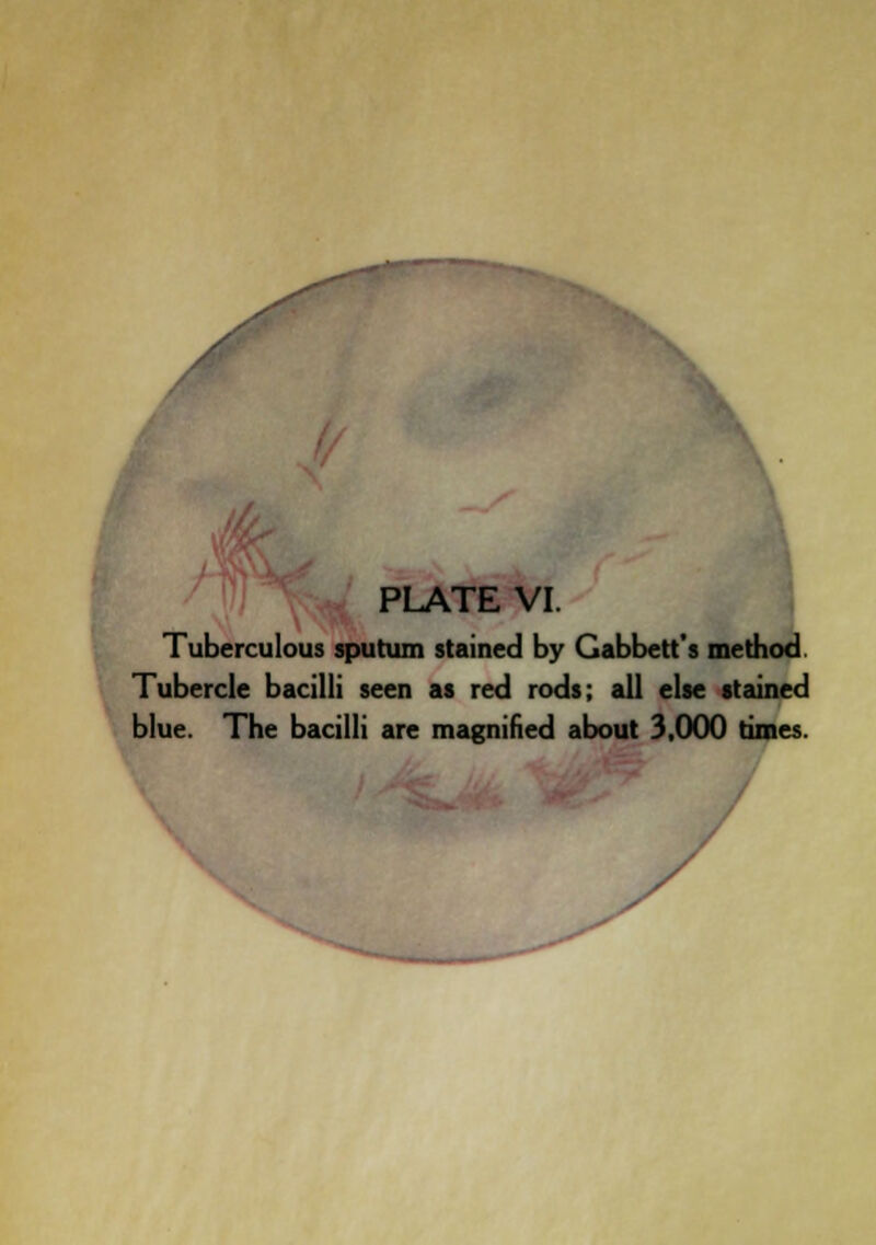 PLATE VI. Tuberculous sputum stained by Gabbett's method. Tubercle bacilli seen as red rods; all else stained blue. The bacilli are magnified about 3,000 times.