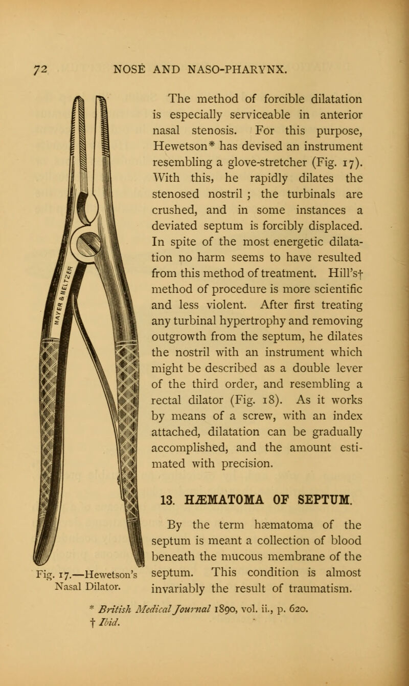 # i' b '\$ The method of forcible dilatation is especially serviceable in anterior nasal stenosis. For this purpose, Hewetson* has devised an instrument resembling a glove-stretcher (Fig. 17). With this, he rapidly dilates the stenosed nostril ; the turbinals are crushed, and in some instances a deviated septum is forcibly displaced. In spite of the most energetic dilata- tion no harm seems to have resulted from this method of treatment. Hill's* method of procedure is more scientific and less violent. After first treating any turbinal hypertrophy and removing outgrowth from the septum, he dilates the nostril with an instrument which might be described as a double lever of the third order, and resembling a rectal dilator (Fig. 18). As it works by means of a screw, with an index attached, dilatation can be gradually accomplished, and the amount esti- mated with precision. 13. HEMATOMA OF SEPTUM. Fig. 17.—Hewetson's Nasal Dilator. By the term hematoma of the septum is meant a collection of blood beneath the mucous membrane of the septum. This condition is almost invariably the result of traumatism. * British Medical Journal 1890, vol. ii., p. 620. f Ibid.