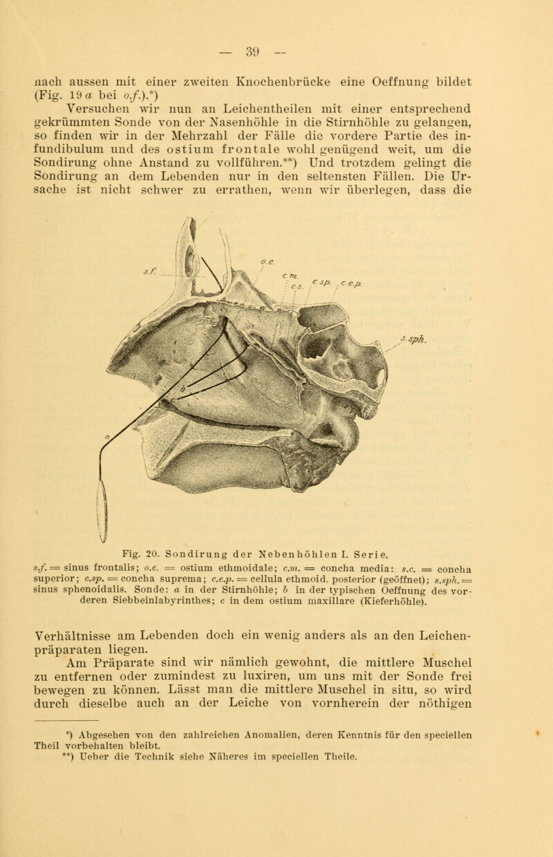 nach aussen mit einer zweiten Knochenbrücke eine Oeffnung bildet (Fig. 19 a bei o.f.).*) Versuchen wir nun an Leichenteilen mit einer entsprechend gekrümmten Sonde von der Nasenhöhle in die Stirnhöhle zu gelangen, so finden wir in der Mehrzahl der Fälle die vordere Partie des in- fundibulum und des ostium frontale wohl genügend weit, um die Sondirung ohne Anstand zu vollführen.**) Und trotzdem gelingt die Sondirung an dem Lebenden nur in den seltensten Fällen. Die Ur- sache ist nicht schwer zu errathen, wenn wir überlegen, dass die ■*pk. Fig. 20. Sondirung der Nebenhöhlen I. Serie. s.f. = sinus frontalis; o.e. = ostium ethmoidale; c.m. = concha media: s.c = concha superior; csp. = concha suprema; ce.p. = cellula ethmoid. posterior (geöffnet); s.sph.= sinus sphenoidalis. Sonde: a in der Stirnhöhle; b in der typischen Oeffnung des vor- deren Siebbeinlabyrinthes; c in dem ostium maxillare (Kieferhöhle). Verhältnisse am Lebenden doch ein wenig anders als an den Leichen- präparaten liegen. Am Präparate sind wir nämlich gewohnt, die mittlere Muschel zu entfernen oder zumindest zu luxiren, um uns mit der Sonde frei bewegen zu können. Lässt man die mittlere Muschel in situ, so wird durch dieselbe auch an der Leiche von vornherein der nöthigen *) Abgesehen von den zahlreichen Anomalien, deren Kenntnis für den speciellen Theil vorbehalten bleibt. **) Ueber die Technik siehe Näheres im speciellen Theile.