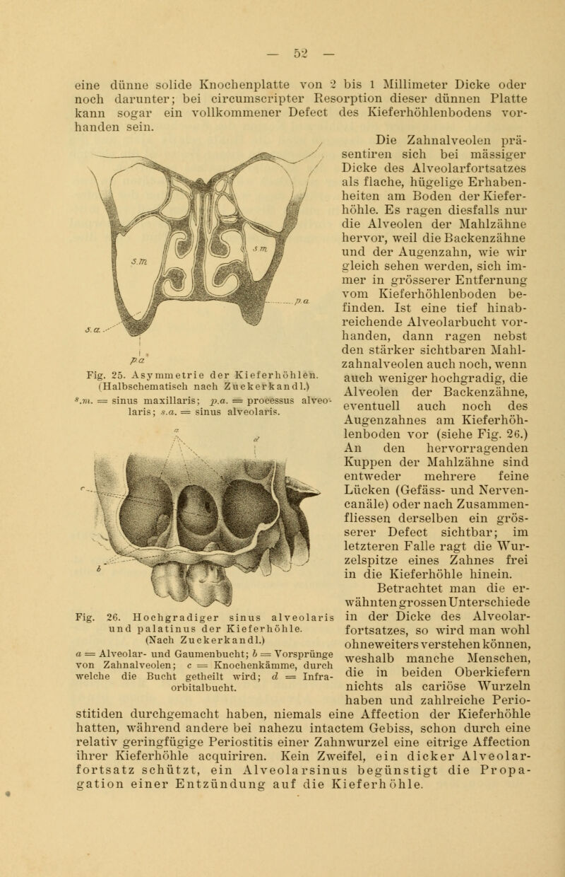 pa Fig. 25. Asymmetrie der Kieferhöhlen. (Halbschematisch nach Zuckerkand 1.) s.m. = sinus maxillaris; p.a. = processus alveo- laris; s.a. = sinus alveolaris. eine dünne solide Knochenplatte von 2 bis l Millimeter Dicke oder noch darunter; bei circumscripter Resorption dieser dünnen Platte kann sogar ein vollkommener Defect des Kieferhöhlenbodens vor- handen sein. Die Zahnalveolen prä- sentiren sich bei massiger Dicke des Alveolarfortsatzes als flache, hügelige Erhaben- heiten am Boden der Kiefer- höhle. Es ragen diesfalls nur die Alveolen der Mahlzähne hervor, weil die Backenzähne und der Augenzahn, wie wir gleich sehen werden, sich im- mer in grösserer Entfernung vom Kieferhöhlenboden be- finden. Ist eine tief hinab- reichende Alveolarbucht vor- handen, dann ragen nebst den stärker sichtbaren Mahl- zahnalveolen auch noch, wenn auch weniger hochgradig, die Alveolen der Backenzähne, eventuell auch noch des Augenzahnes am Kieferhöh- lenboden vor (siehe Fig. 26.) An den hervorragenden Kuppen der Mahlzähne sind entweder mehrere feine Lücken (Gefäss- und Nerven- canäle) oder nach Zusammen- fliessen derselben ein grös- serer Defect sichtbar; im letzteren Falle ragt die Wur- zelspitze eines Zahnes frei in die Kieferhöhle hinein. Betrachtet man die er- wähnten grossen Unterschiede in der Dicke des Alveolar- fortsatzes, so wird man wohl ohneweiters verstehen können, weshalb manche Menschen, die in beiden Oberkiefern nichts als cariöse Wurzeln haben und zahlreiche Perio- stitiden durchgemacht haben, niemals eine Affection der Kieferhöhle hatten, während andere bei nahezu intactem Gebiss, schon durch eine relativ geringfügige Periostitis einer Zahnwurzel eine eitrige Affection ihrer Kieferhöhle acquiriren. Kein Zweifel, ein dicker Alveolar- fortsatz schützt, ein Alveolarsinus begünstigt die Propa- gation einer Entzündung auf die Kieferhöhle. a = von 26. Hochgradiger sinus alveolaris und palatinus der Kieferhöhle. (Xach Zuckerkandl.) Alveolar- und Gaumenbucht; b = Vorsprünge Zahnalveolen; c = Knochenkämme, durch welche die Bucht getheilt wird: orbitalbucht. d = Infra-