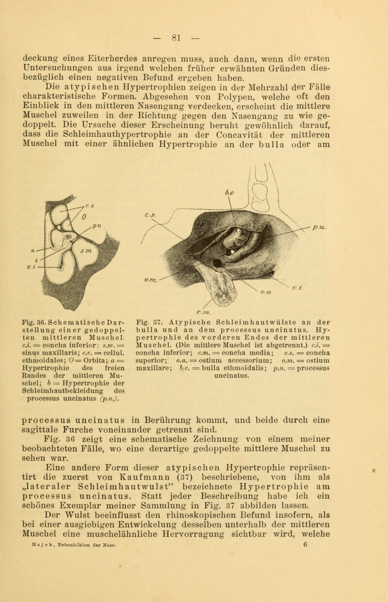 deckung eines Eiterherdes anregen muss, auch dann, wenn die ersten Untersuchungen aus irgend welchen früher erwähnten Gründen dies- bezüglich einen negativen Befund ergeben haben. Die atypischen Hypertrophien zeigen in der Mehrzahl der Fälle charakteristische Formen. Abgesehen von Polypen, welche oft den Einblick in den mittleren Nasengang verdecken, erscheint die mittlere Muschel zuweilen in der Richtung gegen den Nasengang zu wie ge- doppelt. Die Ursache dieser Erscheinung beruht gewöhnlich darauf, dass die Schleimhauthypertrophie an der Concavität der mittleren Muschel mit einer ähnlichen Hypertrophie an der bulla oder am Fig. 36. Schematische Dar- stellung einer gedoppel- ten mittleren Muschel. c.i. = concha inferior: s.m. = sinus maxillaris; c.e. = cellul. ethmoidales; 0 = Orbita; a = Hypertrophie des freien Randes der mittleren Mu- schel; b = Hypertrophie der Schleimhautbekleidung des Processus uncinatus (p.u.J. p u. Fig. 37. Atypische Schleimhautwülste an der bulla und an dem Processus uncinatus. Hy- pertrophie des vorderen Endes der mittleren Muschel. (Die mittlere Muschel ist abgetrennt.) ct. = concha inferior; cm. = concha media; es. = concha superior; o.a. = ostium accessorium; o.m. = ostium maxillare; b.e. = bulla ethmoidalis; p.u. — processus uncinatus. Processus uncinatus in Berührung kommt, und beide durch eine sagittale Furche voneinander getrennt sind. Fig. 36 zeigt eine schematische Zeichnung von einem meiner beobachteten Fälle, wo eine derartige gedoppelte mittlere Muschel zu sehen war. Eine andere Form dieser atypischen Hypertrophie repräsen- tirt die zuerst von Kaufmann (37) beschriebene, von ihm als „lateraler Schleimhautwulst bezeichnete Hypertrophie am Processus uncinatus. Statt jeder Beschreibung habe ich ein schönes Exemplar meiner Sammlung in Fig. 37 abbilden lassen. Der Wulst beeinflusst den rhinoskopischen Befund insofern, als bei einer ausgiebigen Entwickelung desselben unterhalb der mittleren Muschel eine muschelähnliche Hervorragung sichtbar wird, welche Haj ek, Nebenhöhlen der Nase. 6