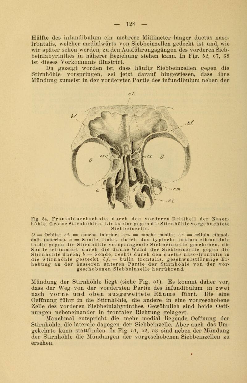 Hälfte des infundibulum ein mehrere Millimeter langer ductus naso- frontalis, welcher medialwärts von Siebbeinzellen gedeckt ist und, wie wir später sehen werden, zu den Ausführungsgängen des vorderen Sieb- beinlabyrinthes in näherer Beziehung stehen kann. In Fig. 52, 67, 68 ist dieses Vorkommnis illustrirt. Da gezeigt worden ist, dass häufig Siebbeinzellen gegen die Stirnhöhle vorspringen, sei jetzt darauf hingewiesen, dass ihre Mündung zumeist in der vordersten Partie des infundibulum neben der öf. hf c.e 0 ci Fig 54. Frontaldur ch schnitt durch den vorderen Dritt heil der Nasen- höhle. Grosse Stirnhöhlen. Links eine gegen die Stirnhöhle vorgebuchtete Siebbeinzelle. O = Orbita; ct. = concha inferior; cm. = concha media; c.e. = cellula ethmoi- dalis (anterior), a = Sonde, links, durch das typische ostium ethmoidale in die gegen die Stirnhöhle vorspringende Siebbeinzelle geschoben, die Sonde schimmert durch die dünne Wand der Siebbeinzelle gegen die Stirnhöhle durch; b = Sonde, rechts durch den ductus naso-frontalis in die Stirnhöhle gesteckt, b.f. = bulla frontalis, geschwulstförmige Er- hebung an der äusseren unteren Partie der Stirnhöhle von der vor- geschobenen Siebbeinzelle herrührend. Mündung der Stirnhöhle liegt (siehe Fig. 51). Es kommt daher vor, dass der Weg von der vordersten Partie des infundibulum in zwei nach vorne und oben ausgeweitete Räume führt. Die eine Oeffnung führt in die Stirnhöhle, die andere in eine vorgeschobene Zelle des vorderen Siebbeinlabyrinthes. Gewöhnlich sind beide Oeff- nungen nebeneinander in frontaler Richtung gelagert. Manchmal entspricht die mehr medial liegende Oeffnung der Stirnhöhle, die laterale dagegen der Siebbeinzelle. Aber auch das Um- gekehrte kann stattfinden. In Fig. 51, 52, 53 sind neben der Mündung der Stirnhöhle die Mündungen der vorgeschobenen Siebbeinzellen zu ersehen.