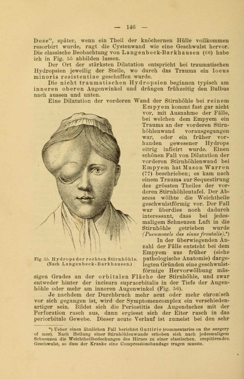 Dose, später, wenn ein Theil der knöchernen Hülle vollkommen resorbirt wurde, ragt die Cystenwand wie eine Geschwulst hervor. Die classische Beobachtung von Langenbeck-Barkhausen (66) habe ich in Fig. 55 abbilden lassen. Der Ort der stärksten Dilatation entspricht bei traumatischen Hydropsien jeweilig der Stelle, wo durch das Trauma ein locus minoris resistentiae geschaffen wurde. Die nicht traumatischen Hydropsien beginnen typisch am inneren oberen Augenwinkel und drängen frühzeitig den Bulbus nach aussen und unten. Eine Dilatation der vorderen Wand der Stirnhöhle bei reinem Empyem kommt fast gar nicht vor, mit Ausnahme der Fälle, bei welchen dem Empyem ein Trauma an der vorderen Stirn- höhlenwand vorausgegangen war, oder ein früher vor- handen gewesener Hydrops eitrig inficirt wurde. Einen schönen Fall von Dilatation der vorderen Stirnhöhlenwand bei Empyem hat Mason Warren (77) beschrieben; es kam nach einem Trauma zur Sequestirung des grössten Theiles der vor- deren Stirnhöhlentafel. Der Ab- scess wölbte die Weichtheile geschwulstförmig vor. Der Fall war überdies noch dadurch interessant, dass bei jedes- maligem Schneuzen Luft in die Stirnhöhle getrieben wurde (Pneumocele des sinusfrontalis).*) In der überwiegenden An- zahl der Fälle entsteht bei dem Empyem aus früher (siehe pathologische Anatomie) darge- legten Gründen eine geschwulst- förmige Hervorwölbung mas- sigen Grades an der orbitalen Fläche der Stirnhöhle, und zwar entweder hinter der incisura supraorbitalis in der Tiefe der Augen- höhle oder mehr am inneren Augenwinkel (Fig. 56). Je nachdem der Durchbruch mehr acut oder mehr chronisch vor sich gegangen ist, wird der Symptomencomplex ein verschieden- artiger sein. Bildet sich die Periostitis des Augendaches mit der Perforation rasch aus, dann ergiesst sich der Eiter rasch in das periorbitale Gewebe. Dieser acute Verlauf ist zumeist bei den sehr Fig. 55. Hydrops der rechten Stirnhöhle. (Nach Langenbeck-Barkhausen.) *) Ueber einen ähnlichen Fall berichtet Guttirie (commentaries on the surgery of mer). Nach Heilung einer Stirnhöhlenwunde erhoben sich nach jedesmaligem Schneuzen die Weichtheilbedeckungen des Hirnes zu einer elastischen, crepitirenden Geschwulst, so dass der Kranke eine Compressionsbandage tragen musste.