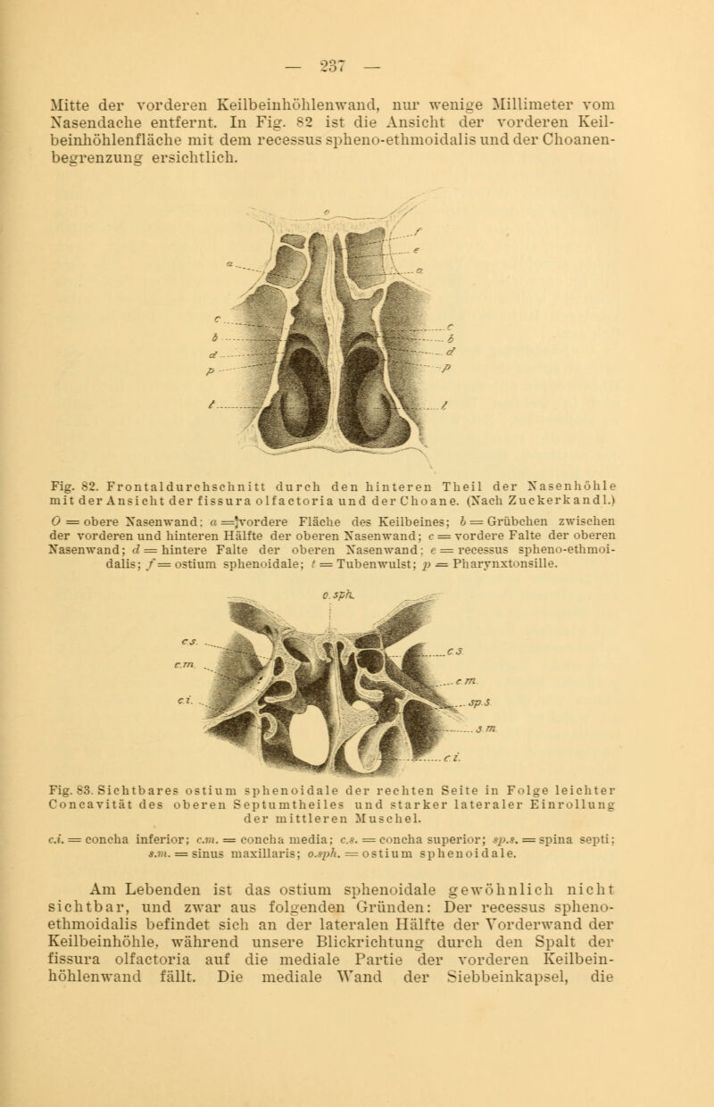 9 ZOi Mitte der vorderen Keilbeinhöhlenwand, nur wenige Millimeter vom Nasendache entfernt. In Fig. 82 ist die Ansicht der vorderen Keil- beinhöhlenfläche mit dem recessus spheno-ethmoidalisund der Choanen- beeTenzuno- ersichtlich. Fig. 82. Frontaldurchschnitt durch den hinteren Theil der Nasenhöhle mit der Ansicht der fissura olfactoria und der Choane. (Nach Zuckerkandl.) 0 = obere Xasenwand: a =Jvordere Fläche des Keilbeines; b = Grübchen zwischen der vorderen und hinteren Hälfte der oberen Xasenwand; c = vordere Falte der oberen Xasenwand; d = hintere Falte der oberen Xasenwand: e = recessus spheno-ethmoi- dalis; /=ostium sphenoidale; / = Tubenwulst; p = Pharynxtonsille. o. spn. Fig. 83. Sichtbares ostium sphenoidale der rechten Seite in Folge leichter Concavität des oberen Septumtheiles und starker lateraler Einrollung der mittleren Muschel. c.i. = concha inferior; cm. = concha media; es. = concha superior; *p.*. = spina septi; s.m. = sinus maxillaris; o.sph. = ostium sphenoidale. Am Lebenden ist das ostium sphenoidale gewöhnlich nicht sichtbar, und zwar aus folgenden Gründen: Der recessus spheno- ethmoidalis befindet sich an der lateralen Hälfte der Vorderwand der Keilbeinhöhle, während unsere Blickrichtung durch den Spalt der fissura olfactoria auf die mediale Partie der vorderen Keilbein- höhlenwand fällt. Die mediale Wand der Siebbeinkapsel, die