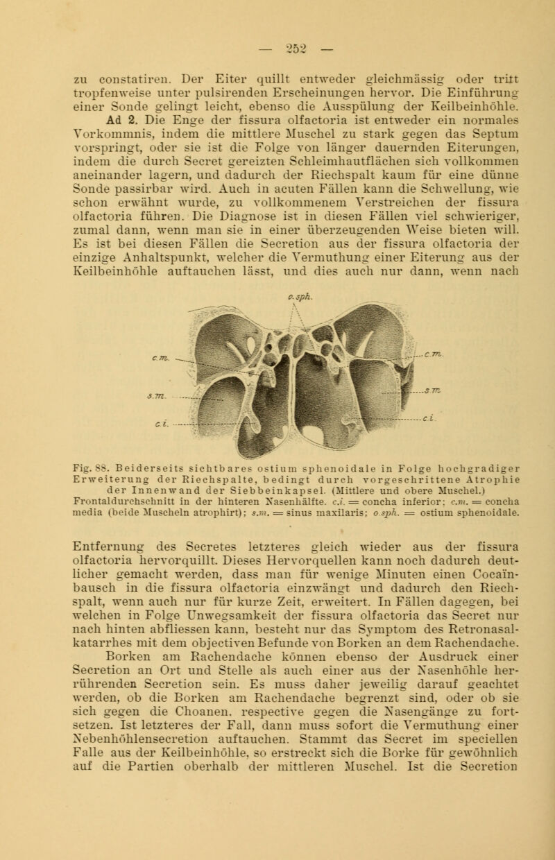 zu constatiren. Der Eiter quillt entweder gleichmässig oder tritt tropfenweise unter pulsirenden Erscheinungen hervor. Die Einführung einer Sonde gelingt leicht, ebenso die Ausspülung der Keilbeinhöhle. Ad 2. Die Enge der fissura olfactoria ist entweder ein normales Vorkommnis, indem die mittlere Muschel zu stark gegen das Septum vorspringt, oder sie ist die Folge von länger dauernden Eiterungen, indem die durch Secret gereizten Schleimhautflächen sich vollkommen aneinander lagern, und dadurch der Riechspalt kaum für eine dünne Sonde passirbar wird. Auch in acuten Fällen kann die Schwellung, wie schon erwähnt wurde, zu vollkommenem Verstreichen der fissura olfactoria führen. Die Diagnose ist in diesen Fällen viel schwieriger, zumal dann, wenn man sie in einer überzeugenden Weise bieten will. Es ist bei diesen Fällen die Secretion aus der fissura olfactoria der einzige Anhaltspunkt, welcher die Vermuthung einer Eiterung aus der Keilbeinhöhle auftauchen lässt, und dies auch nur dann, wenn nach Fig. SS. Beiderseits sichtbares ostium sphenoidale in Folge hochgradiger Erweiterung der Riech spalte, bedingt durch vorgeschrittene Atrophie der Innenwand der Siebbeinkapsel. (Mittlere und obere Muschel.) Frontaldurchschnitt in der hinteren Nasenhälfte, c.i. = concha inferior: cm. = concha media (beide Muscheln atrophirt); s.m. = sinus maxilaris; o.sph. = ostium sphenoidale. Entfernung des Secretes letzteres gleich wieder aus der fissura olfactoria hervorquillt. Dieses Hervorquellen kann noch dadurch deut- licher gemacht werden, dass man für wenige Minuten einen Cocain- bausch in die fissura olfactoria einzwängt und dadurch den Riech- spalt, wenn auch nur für kurze Zeit, erweitert. In Fällen dagegen, bei welchen in Folge Unwegsamkeit der fissura olfactoria das Secret nur nach hinten abfliessen kann, besteht nur das Symptom des Retronasal- katarrhes mit dem objectiven Befunde von Borken an dem Rachendache. Borken am Rachendache können ebenso der Ausdruck einer Secretion an Ort und Stelle als auch einer aus der Nasenhöhle her- rührenden Secretion sein. Es muss daher jeweilig darauf geachtet werden, ob die Borken am Rachendache begrenzt sind, oder ob sie sich gegen die Choanen. respective gegen die Nasengänge zu fort- setzen. Ist letzteres der Fall, dann muss sofort die Vermuthung einer Xebenhöhlensecretion auftauchen. Stammt das Secret im speciellen Falle aus der Keilbeinhöhle, so erstreckt sich die Borke für gewöhnlich auf die Partien oberhalb der mittleren Muschel. Ist die Secretion