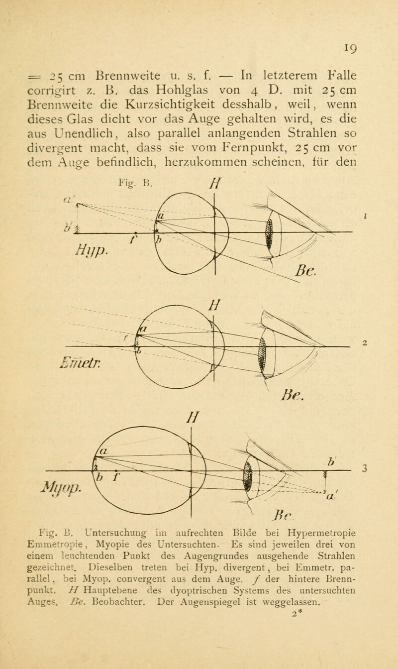 —: 25 cm Brennweite u. s. f. — In letzterem Falle corrigirt z. B. das Hohlglas von 4 D. mit 25 cm Brennweite die Kurzsichtigkeit desshalb, weil, wenn dieses Glas dicht vor das Auge gehalten wird, es die aus Unendlich, also parallel anlangenden Strahlen so divergent macht, dass sie vom Fernpunkt, 25 cm vor dem Auge befindlich, herzukommen scheinen, für den Fig. J i_S. >v * i Hijp. r iL <L Be. bmar. II /a \. rOv V^T^ b Myop. r f J  ~^--f-V,^-, 1 Bc ÖL Fig. B. Untersuchung im aufrechten Bilde bei Hypermetropie Emmetropie , Myopie des Untersuchten. Es sind jeweilen drei von einem leuchtenden Punkt des Augengrundes ausgehende Strahlen gezeichnet. Dieselben treten bei Hyp. divergent, bei Emmetr. pa- rallel , bei Myop, convergent aus dem Auge, f der hintere Brenn- punkt. II Hauptebene des dyoptrischen Systems des untersuchten Auges. Be. Beobachter. Der Augenspiegel ist weggelassen. 2*