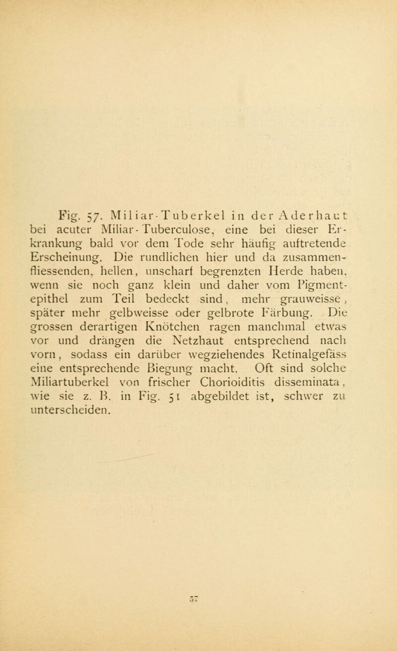 bei acuter Miliar-Tuberculose, eine bei dieser Er- krankung bald vor dem Tode sehr häufig auftretende Erscheinung. Die rundlichen hier und da zusammen- fliessenden, hellen, unscharf begrenzten Herde haben, wenn sie noch ganz klein und daher vom Pigment- epithel zum Teil bedeckt sind, mehr grauweisse, später mehr gelbweisse oder gelbrote Färbung. Die grossen derartigen Knötchen ragen manchmal etwas vor und drängen die Netzhaut entsprechend nach vorn, sodass ein darüber wegziehendes Retinaigefäss eine entsprechende Biegung macht. Oft sind solche Miliartuberkel von frischer Chorioiditis disseminata. wie sie z. B. in Fig. 51 abgebildet ist, schwer zu unterscheiden.