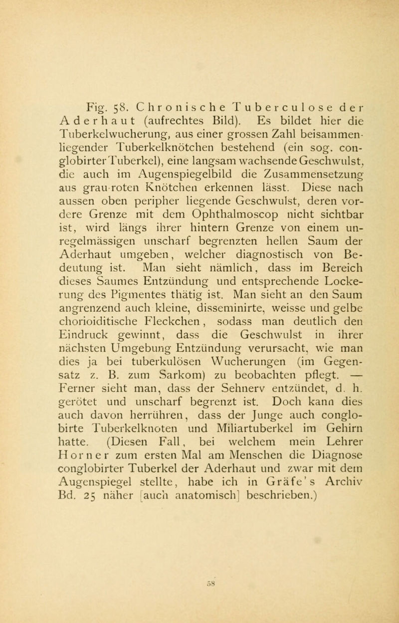 Ader haut (aufrechtes Bild). Es bildet hier die Tuberkelwucherung, aus einer grossen Zahl beisammen- liegender Tuberkelknötchen bestehend (ein sog. con- globirter Tuberkel), eine langsam wachsende Geschwulst, die auch im Augenspiegelbild die Zusammensetzung aus grau roten Knötchen erkennen lässt. Diese nach aussen oben peripher liegende Geschwulst, deren vor- dere Grenze mit dem Ophthalmoscop nicht sichtbar ist, wird längs ihrer hintern Grenze von einem un- regelmässigen unscharf begrenzten hellen Saum der Aderhaut umgeben, welcher diagnostisch von Be- deutung ist. Man sieht nämlich, dass im Bereich dieses Saumes Entzündung und entsprechende Locke- rung des Pigmentes thätig ist. Man sieht an den Saum angrenzend auch kleine, disseminirte, weisse und gelbe chorioiditische Fleckchen, sodass man deutlich den Eindruck gewinnt, dass die Geschwulst in ihrer nächsten Umgebung Entzündung verursacht, wie man dies ja bei tuberkulösen Wucherungen (im Gegen- satz z. B. zum Sarkom) zu beobachten pflegt. — Ferner sieht man, dass der Sehnerv entzündet, d. h. gerötet und unscharf begrenzt ist. Doch kann dies auch davon herrühren, dass der Junge auch conglo- birte Tuberkelknoten und Miliartuberkel im Gehirn hatte. (Diesen Fall, bei welchem mein Lehrer Homer zum ersten Mal am Menschen die Diagnose conglobirter Tuberkel der Aderhaut und zwar mit dem Augenspiegel stellte, habe ich in Gräfe's Archiv Bd. 25 näher auch anatomisch] beschrieben.)