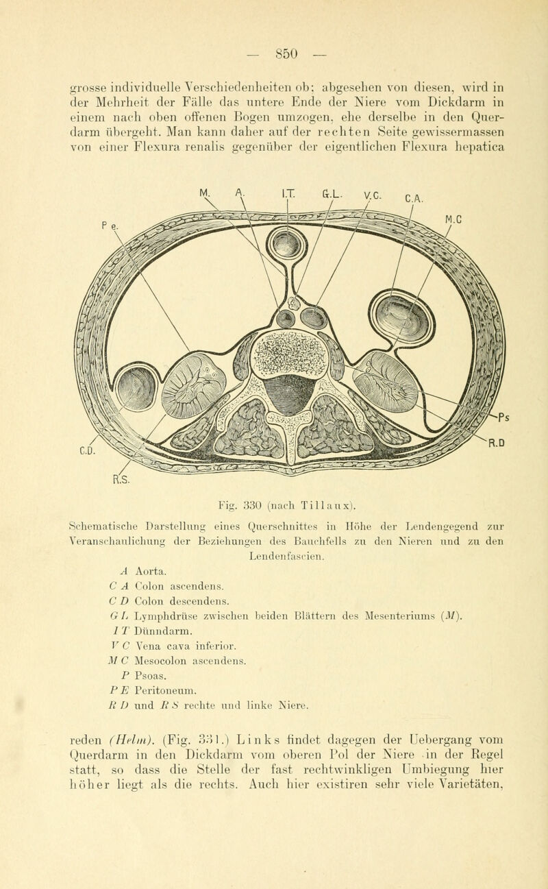 grosse individuelle Verschiedenheiten ob; abgesehen von diesen, wird in der Mehrheit der Fälle das untere Ende der Niere vom Dickdarm in einem nach oben offenen Bogen umzogen, ehe derselbe in den Quer- darm übergeht. Man kann daher auf der rechten Seite gewissermassen von einer Flexura renalis gegenüber der eigentlichen Flexura hepatica Fig. 330 (nach Tillaux). Schematische Darstellung eines Querschnittes in Höhe der Lendengegend zur Veranschaulichung der Beziehungen des Bauchfells zu den Nieren und zu den Lendenfascien. A Aorta. C A Colon ascendens. C D Colon descendens. G L Lymphdrüse zwischen beiden Blättern des Mesenteriums (M). I T Dünndarm. V C Vena cava inferior. M C Mesocolon ascendens. P Psoas. P E Peritoneum. R D und R S rechte und linke Niere. reden (Helm). (Fig. 381.) Links findet dagegen der Uebergang vom Querdarm in den Dickdarm vom oberen Pol der Niere in der Regel statt, so dass die Stelle der fast rechtwinkligen Umbiegung hier höher liegt als die rechts. Auch hier existiren sehr viele Varietäten,