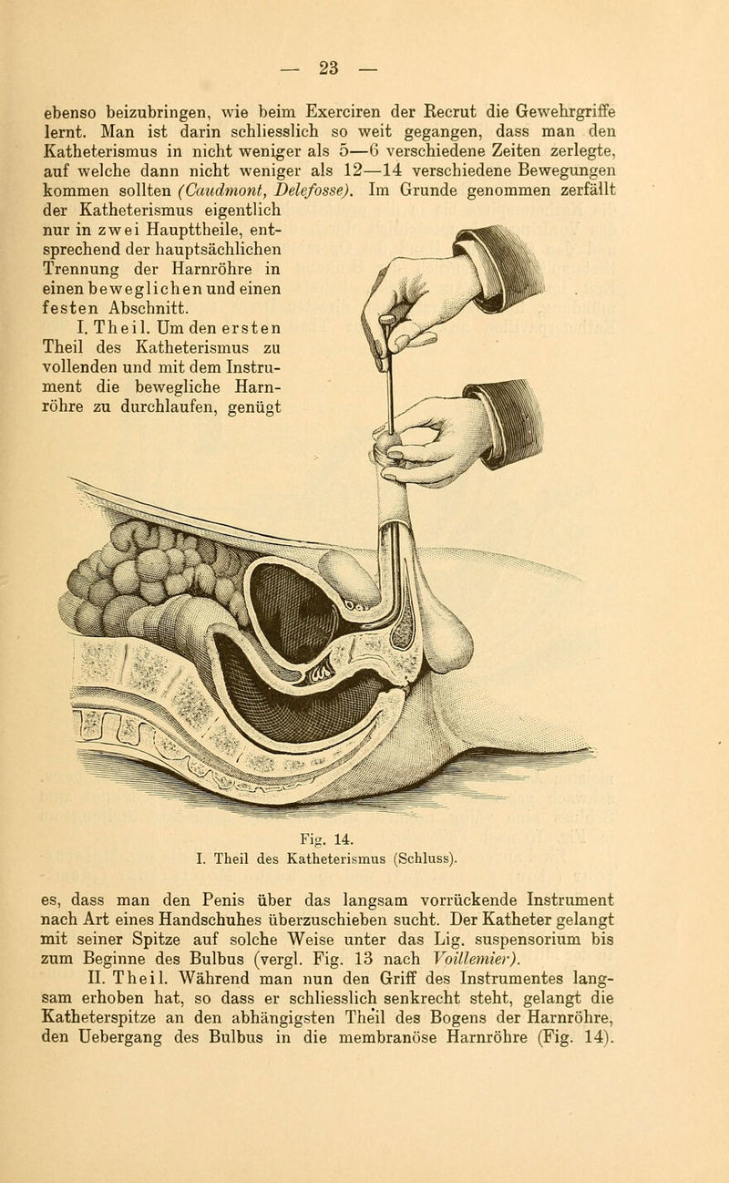 ebenso beizubringen, wie beim Exerciren der Recrut die Gewehrgriffe lernt. Man ist darin schliesslich so weit gegangen, dass man den Katheterismus in nicht weniger als 5—6 verschiedene Zeiten zerlegte, auf welche dann nicht weniger als 12—14 verschiedene Bewegungen kommen sollten (Ccmdmont, Delefosse). Im Grunde genommen zerfällt der Katheterismus eigentlich nur in zwei Haupttheile, ent- sprechend der hauptsächlichen Trennung der Harnröhre in einen beweglichen und einen festen Abschnitt. I. Theil. Um den ersten Theil des Katheterismus zu vollenden und mit dem Instru- ment die bewegliche Harn- röhre zu durchlaufen, genügt Fig. 14. I. Theil des Katheterismus (Schluss). es, dass man den Penis über das langsam vorrückende Instrument nach Art eines Handschuhes überzuschieben sucht. Der Katheter gelangt mit seiner Spitze auf solche Weise unter das Lig. Suspensorium bis zum Beginne des Bulbus (vergl. Fig. 13 nach Voülemier). IL Theil. Während man nun den Griff des Instrumentes lang- sam erhoben hat, so dass er schliesslich senkrecht steht, gelangt die Katheterspitze an den abhängigsten Theil des Bogens der Harnröhre, den Uebergang des Bulbus in die membranöse Harnröhre (Fig. 14).
